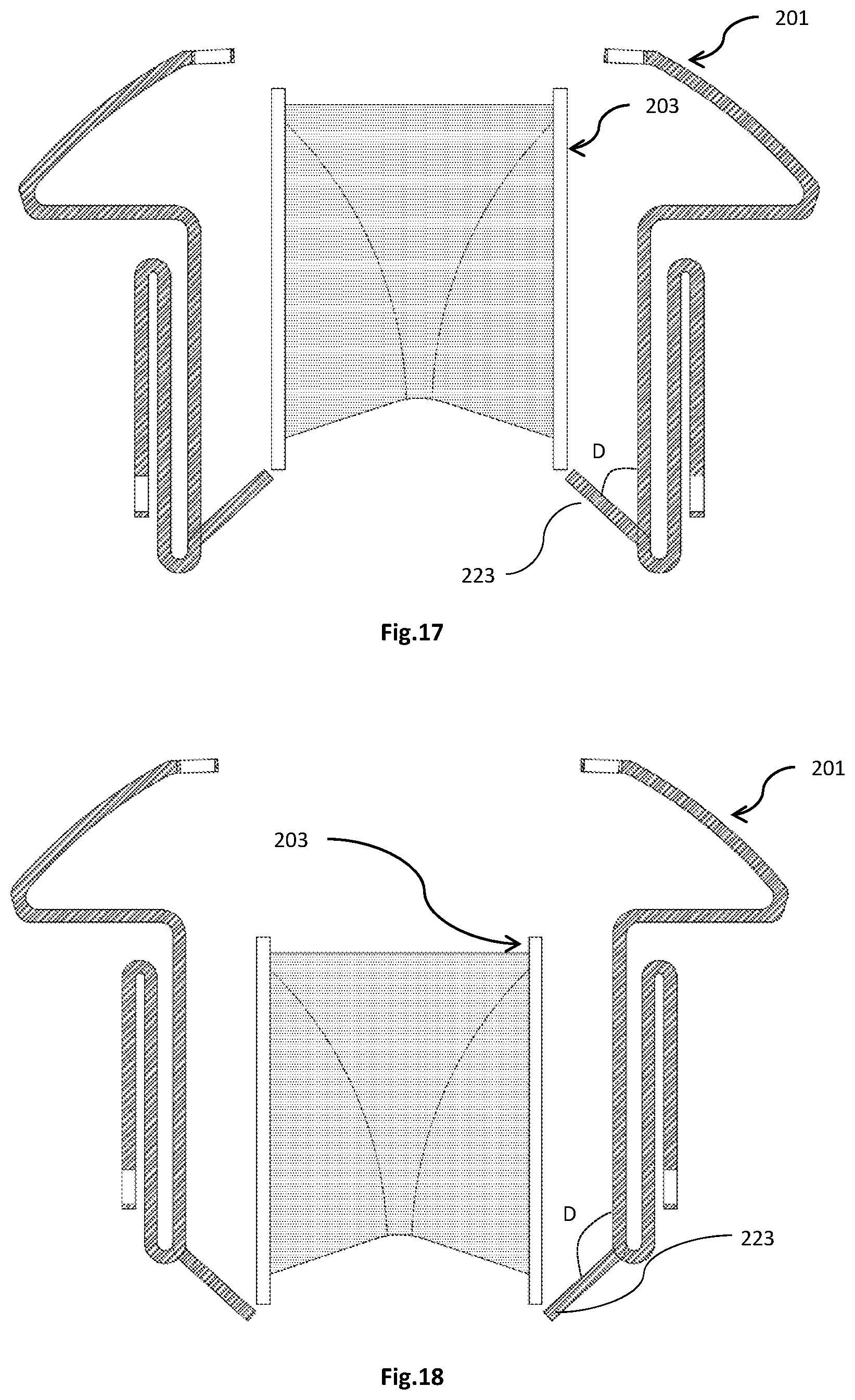 Patent US12318282 Figure 12 – Transapical implantable mitral valve device