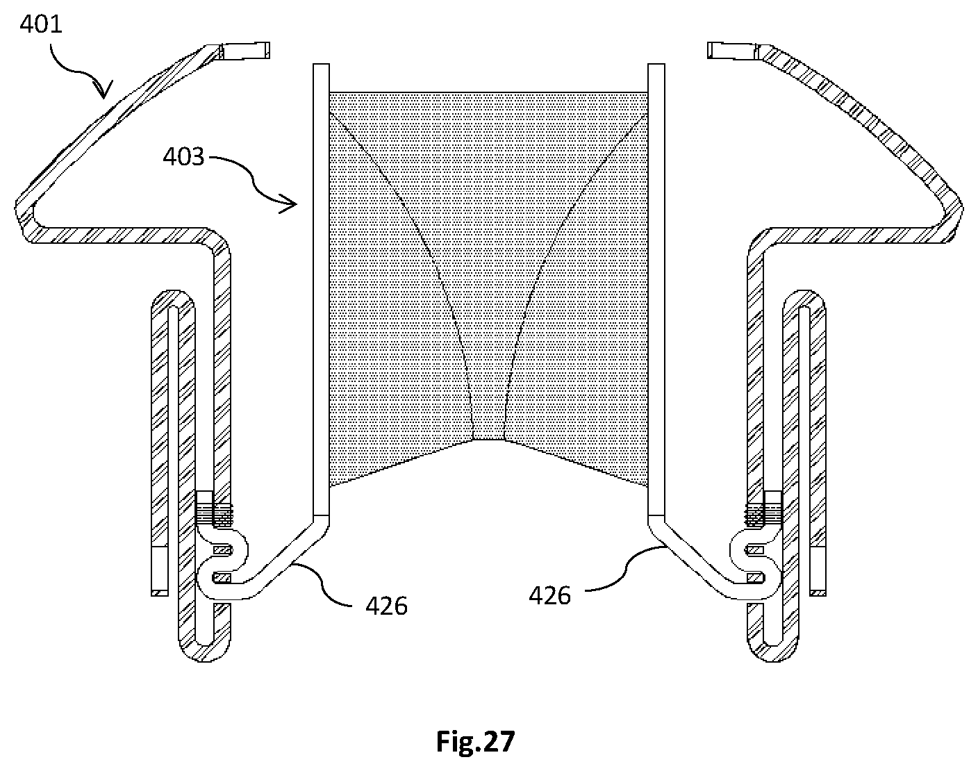 Patent US12318282 Figure 17 – Transapical implantable mitral valve device