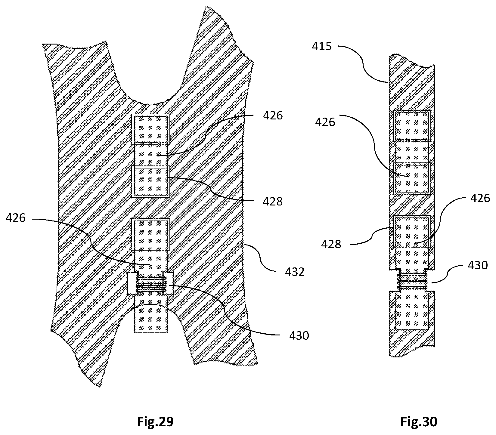 Patent US12318282 Figure 19 – Transapical implantable mitral valve device