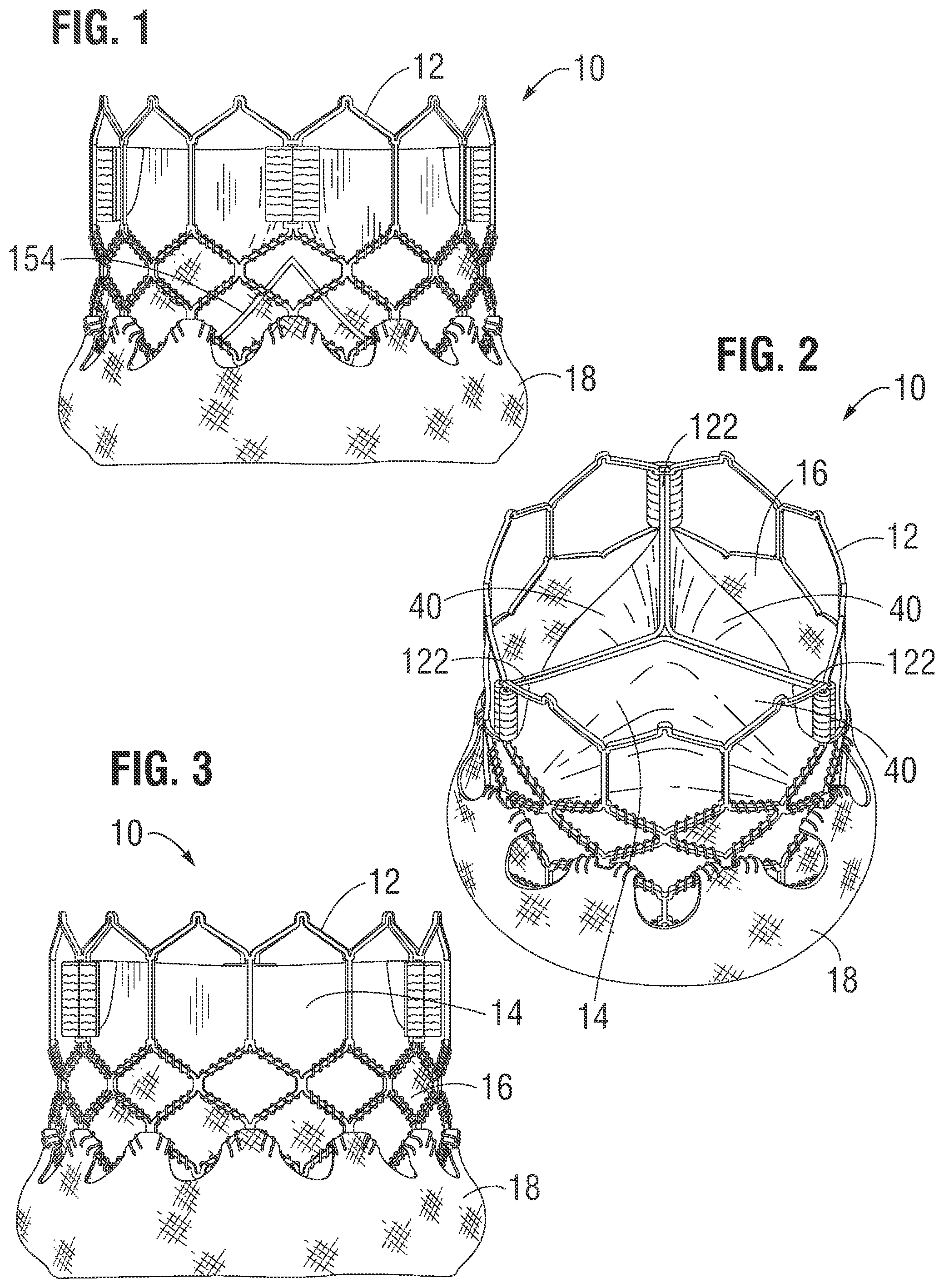Patent US12318283 Figure 1 – Prosthetic heart valve