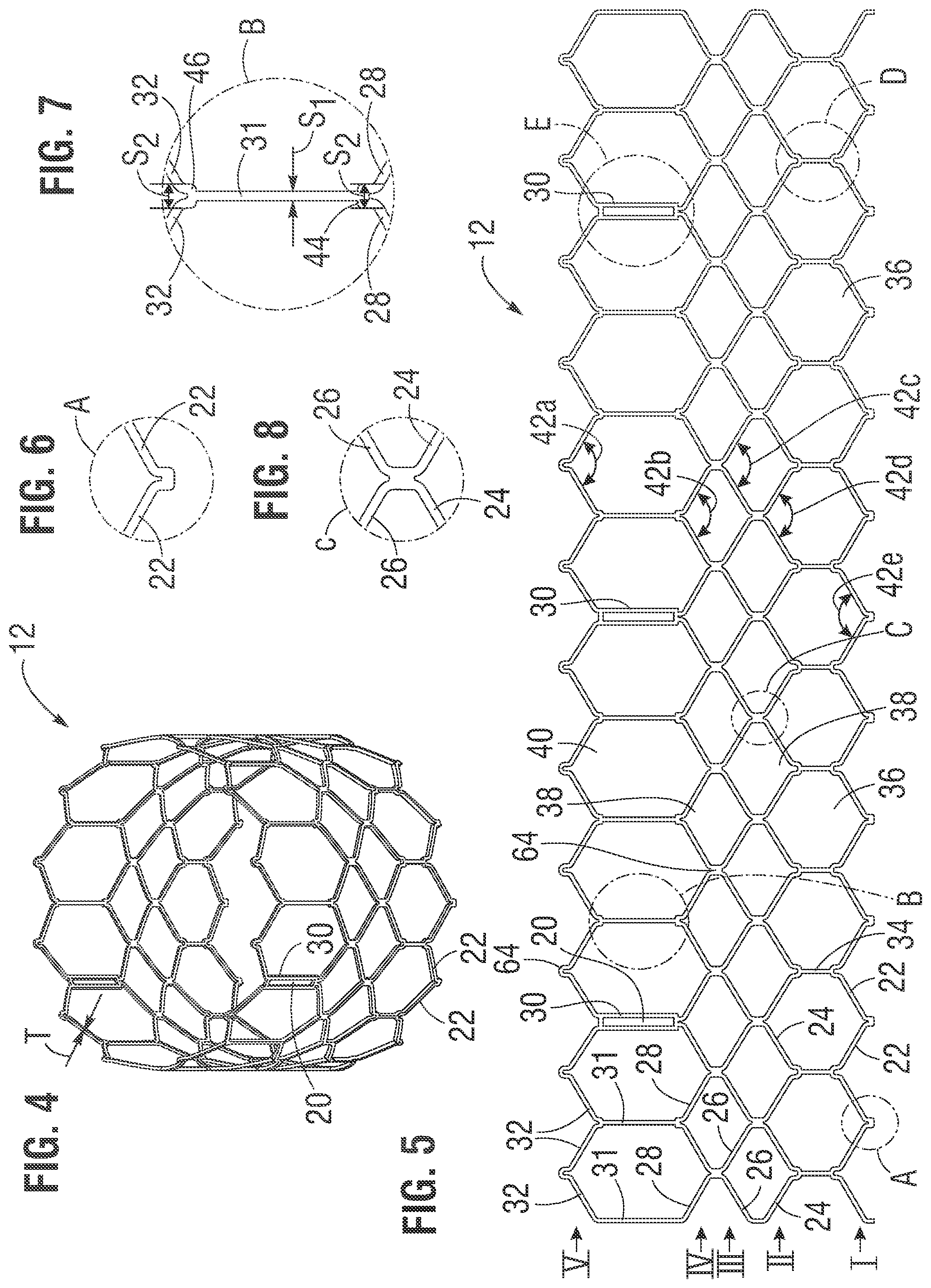 Patent US12318283 Figure 2 – Prosthetic heart valve