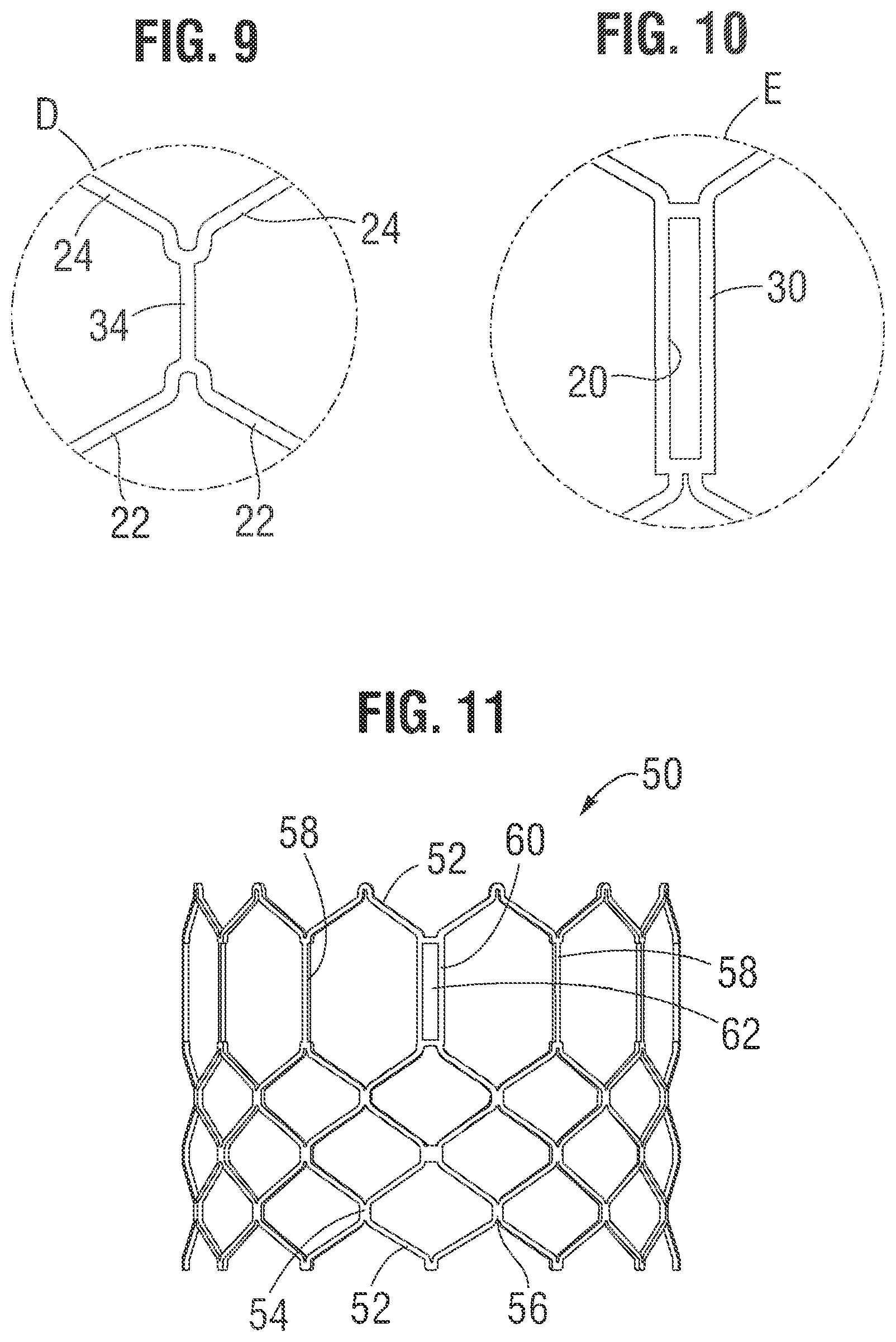 Patent US12318283 Figure 3 – Prosthetic heart valve