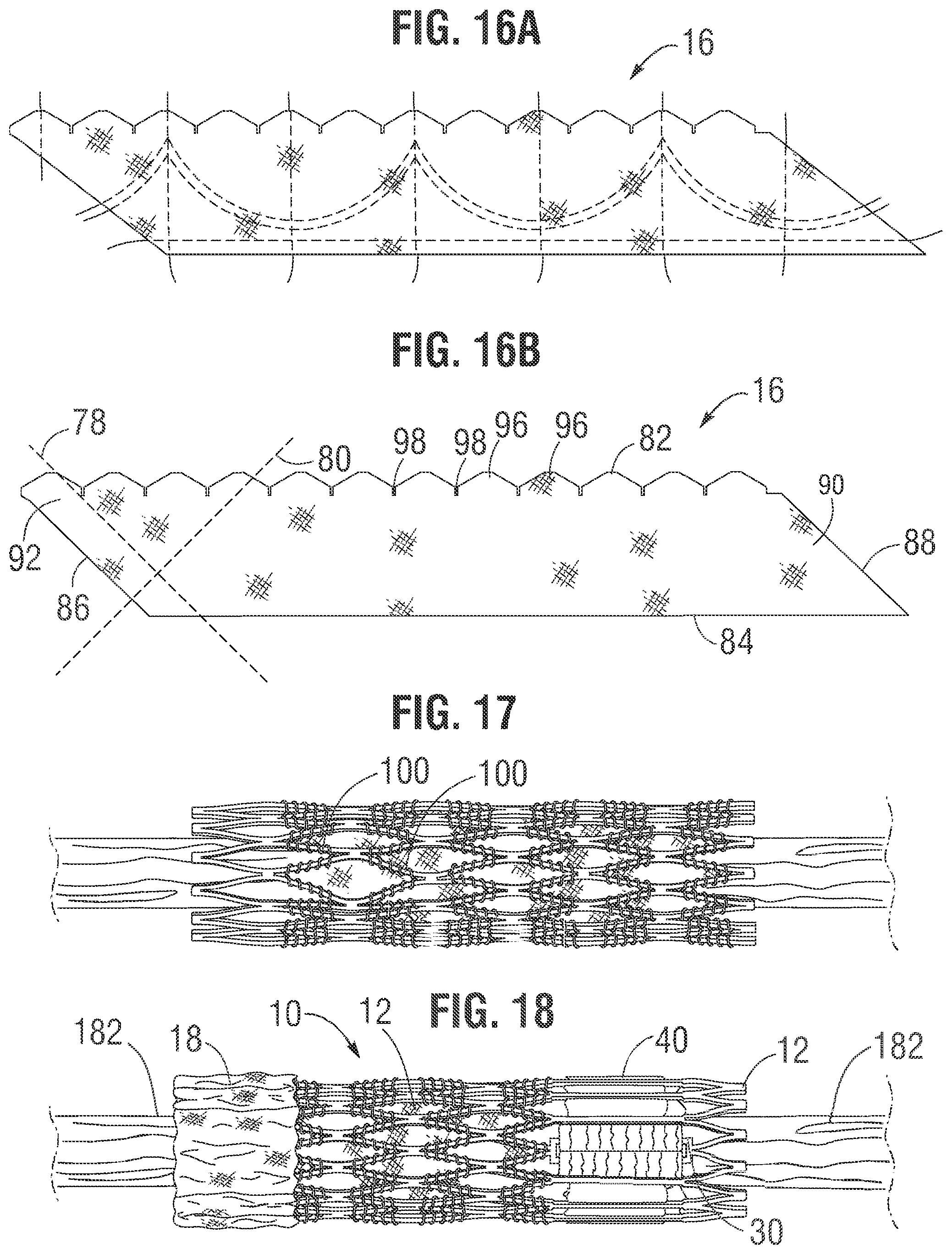 Patent US12318283 Figure 5 – Prosthetic heart valve