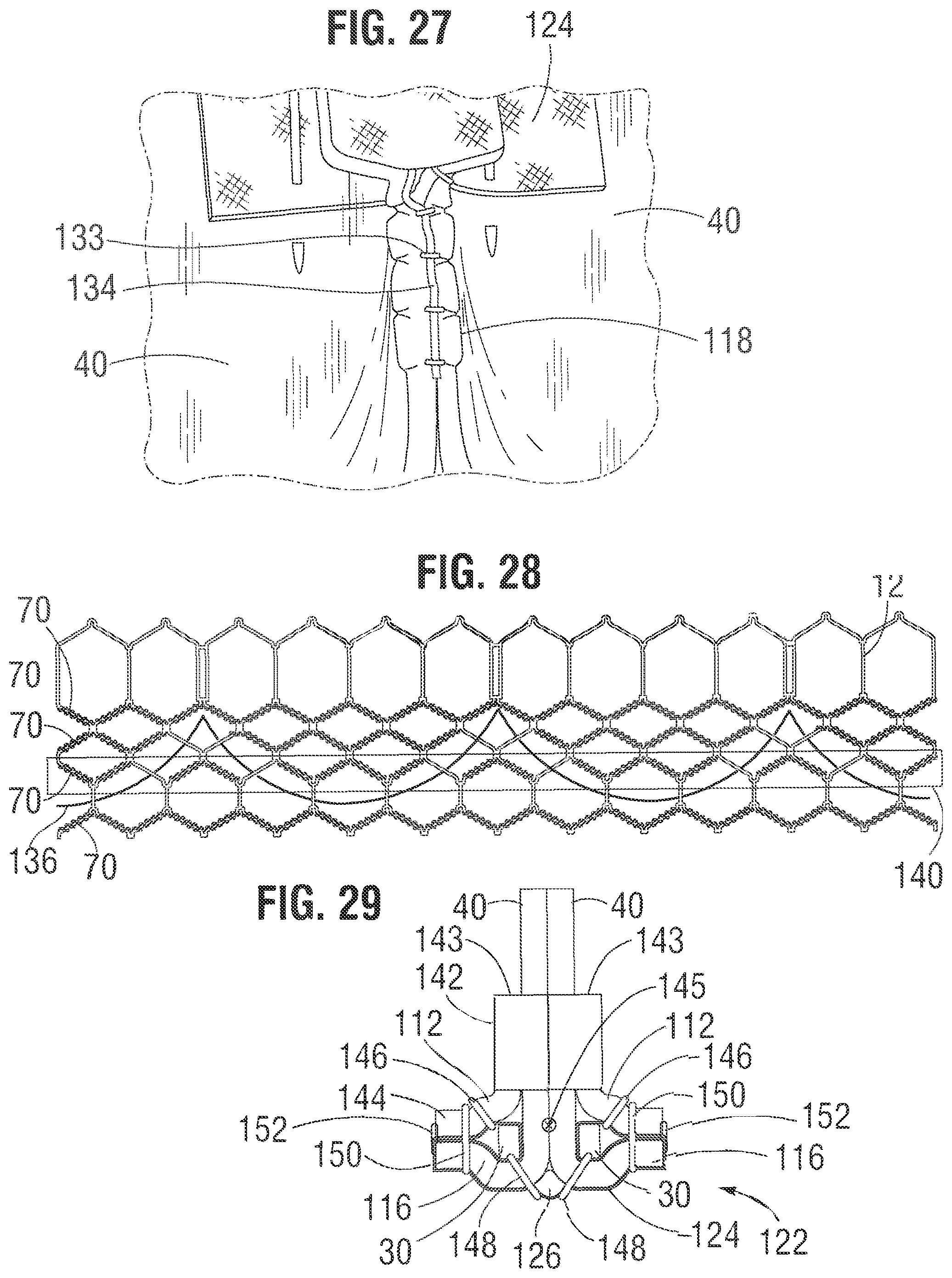 Patent US12318283 Figure 9 – Prosthetic heart valve