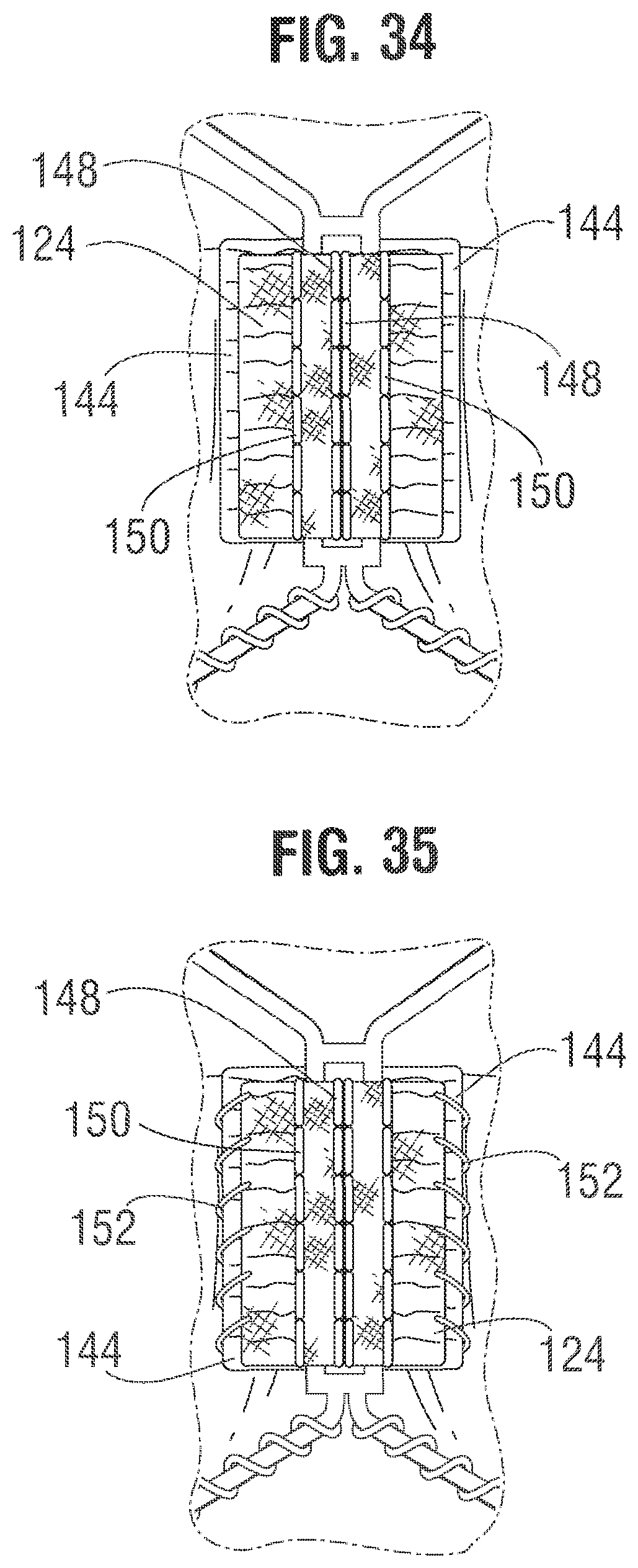 Patent US12318283 Figure 12 – Prosthetic heart valve