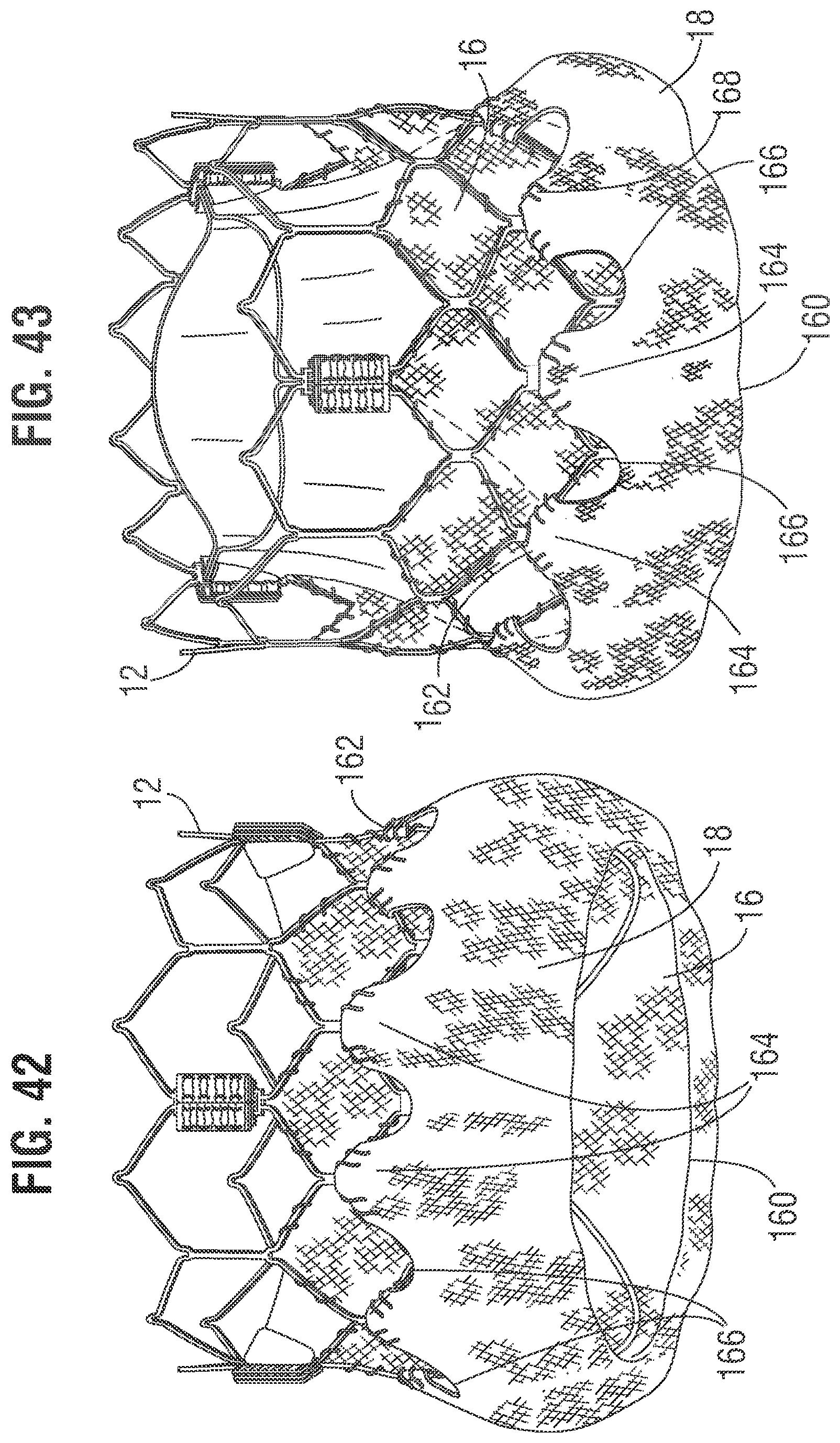 Patent US12318283 Figure 15 – Prosthetic heart valve