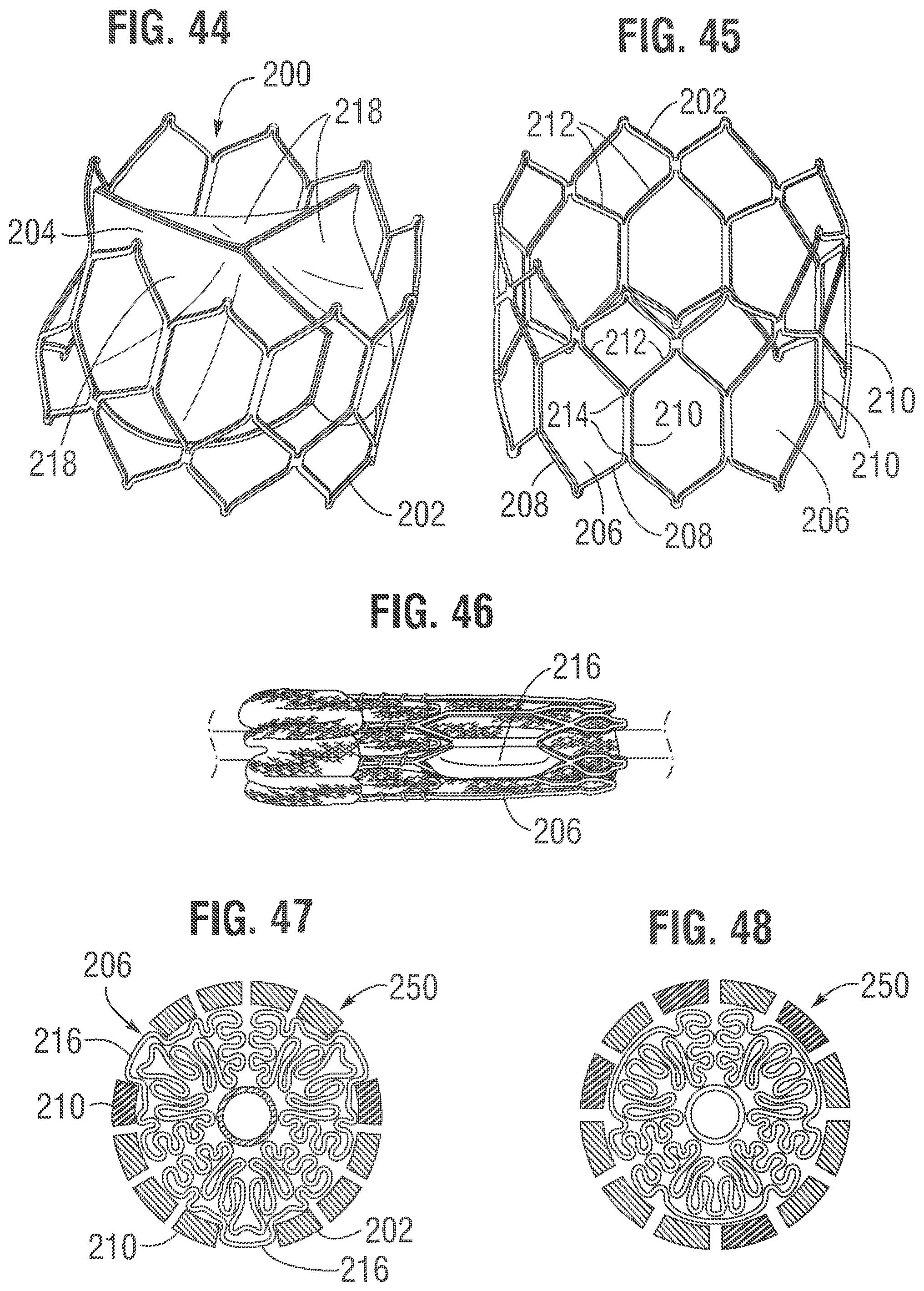 Patent US12318283 Figure 16 – Prosthetic heart valve