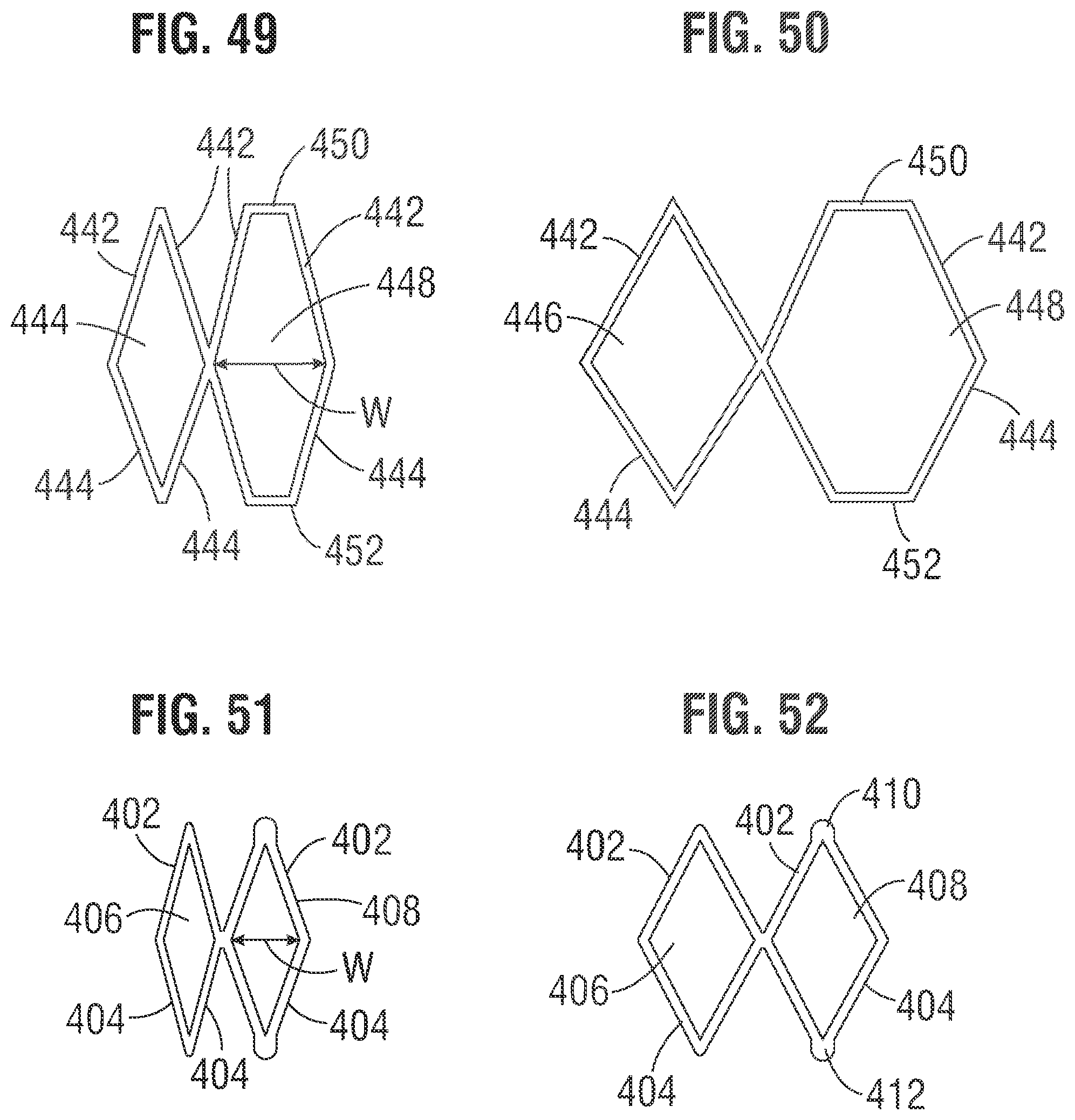 Patent US12318283 Figure 17 – Prosthetic heart valve