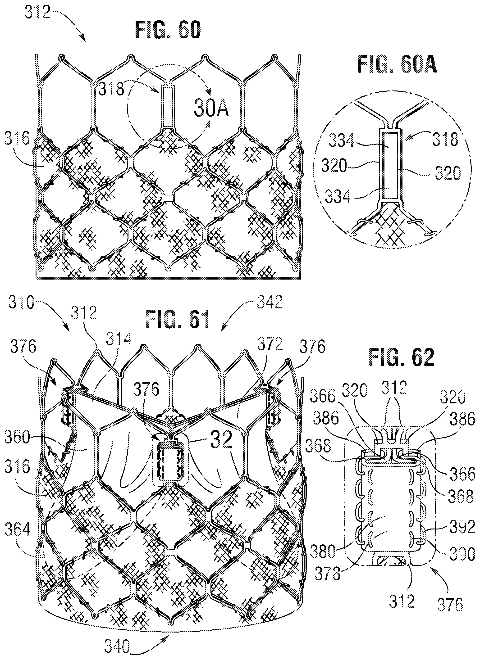 Patent US12318283 Figure 20 – Prosthetic heart valve