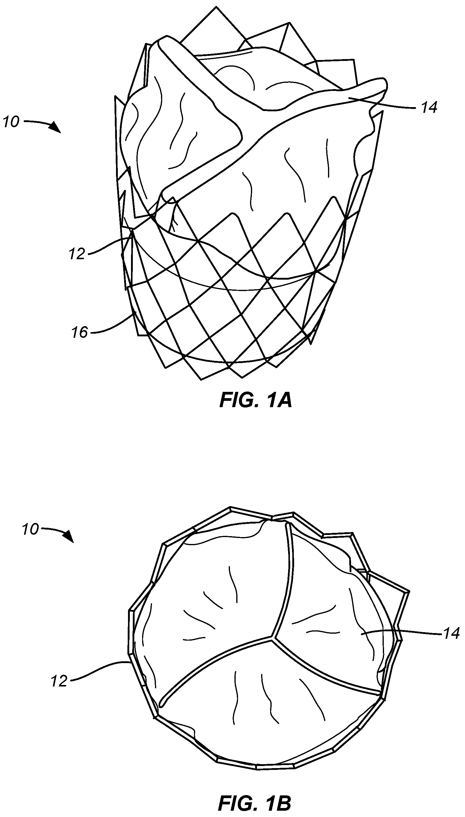 Patent US12318284 Figure 1 – Endovascular prosthetic heart valve replacement