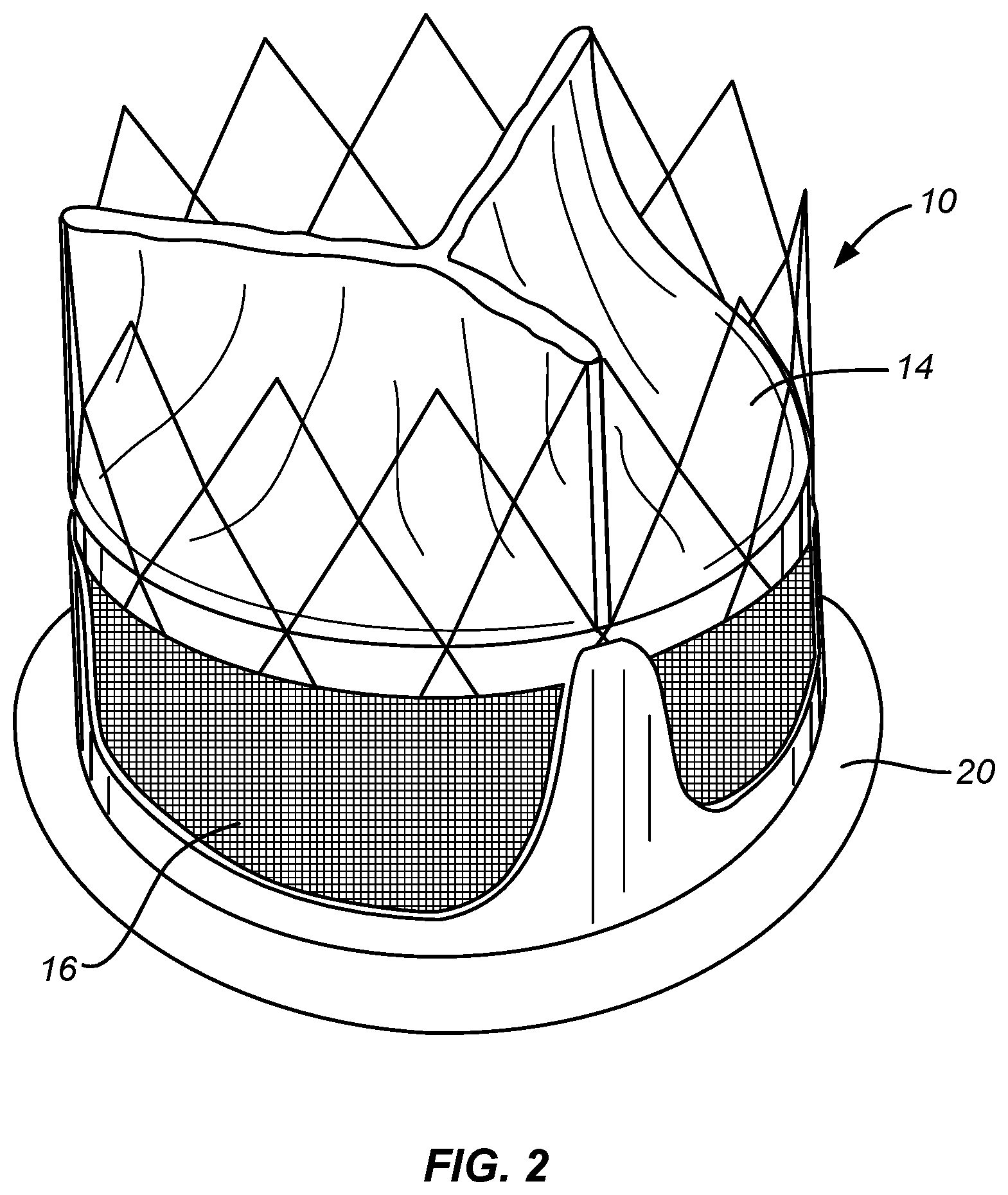 Patent US12318284 Figure 2 – Endovascular prosthetic heart valve replacement