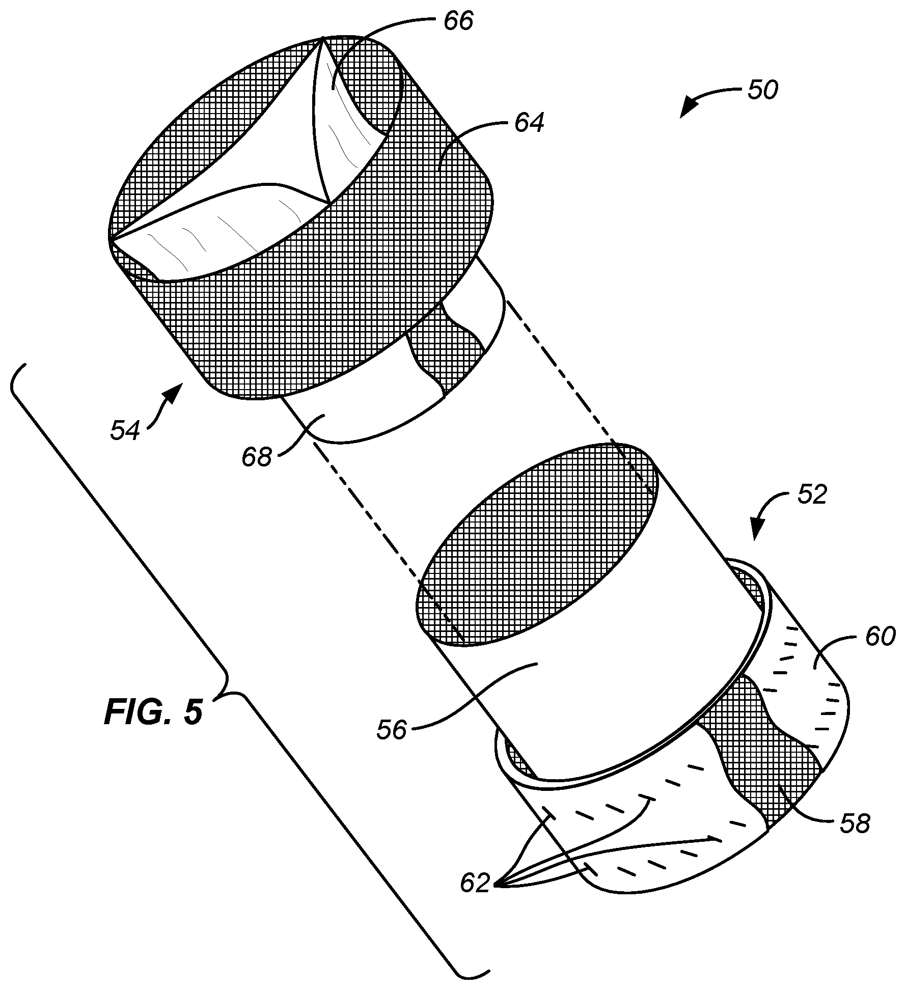 Patent US12318284 Figure 5 – Endovascular prosthetic heart valve replacement