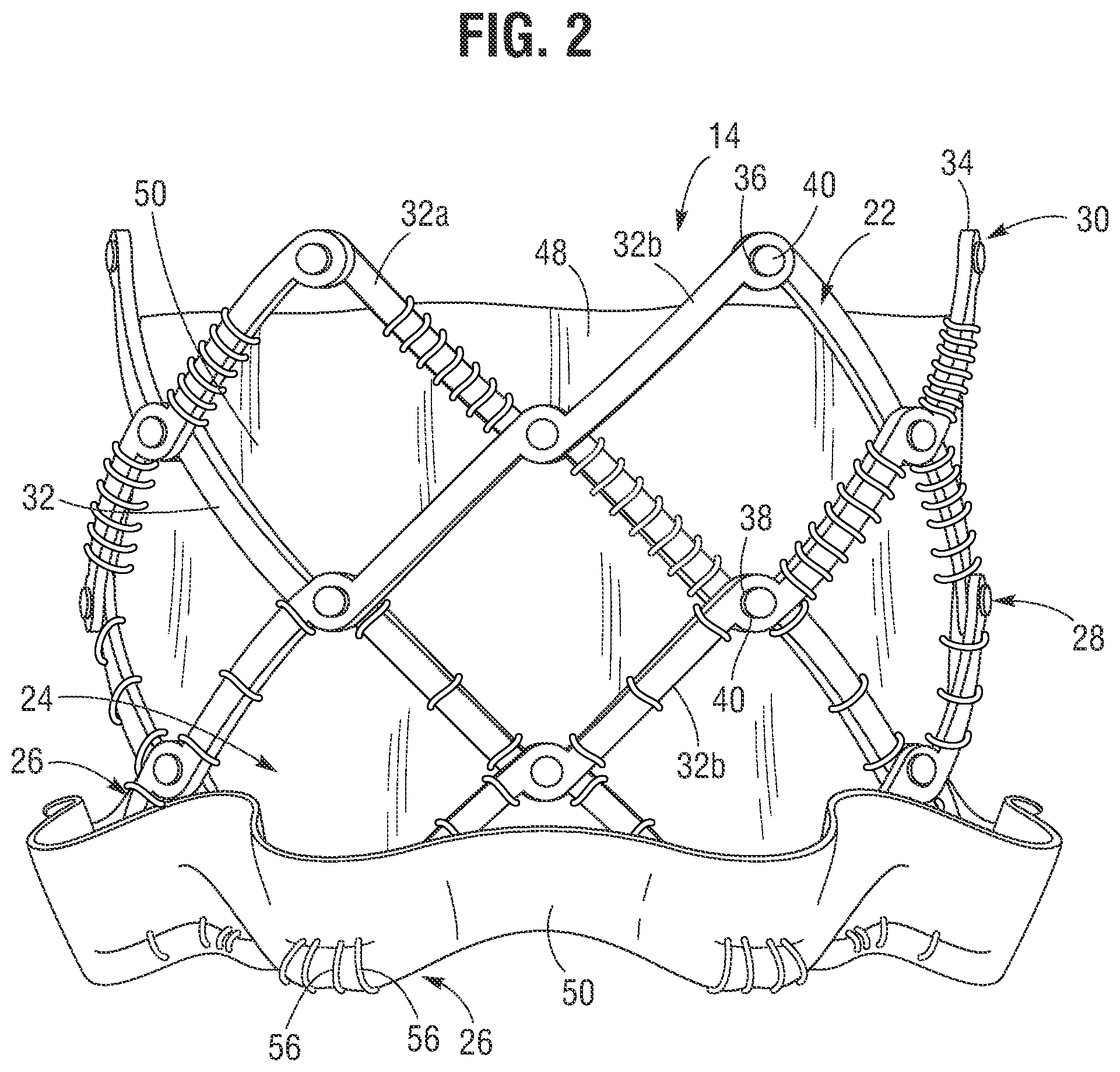 Patent US12318285 Figure 2 – Mechanically expandable heart valve