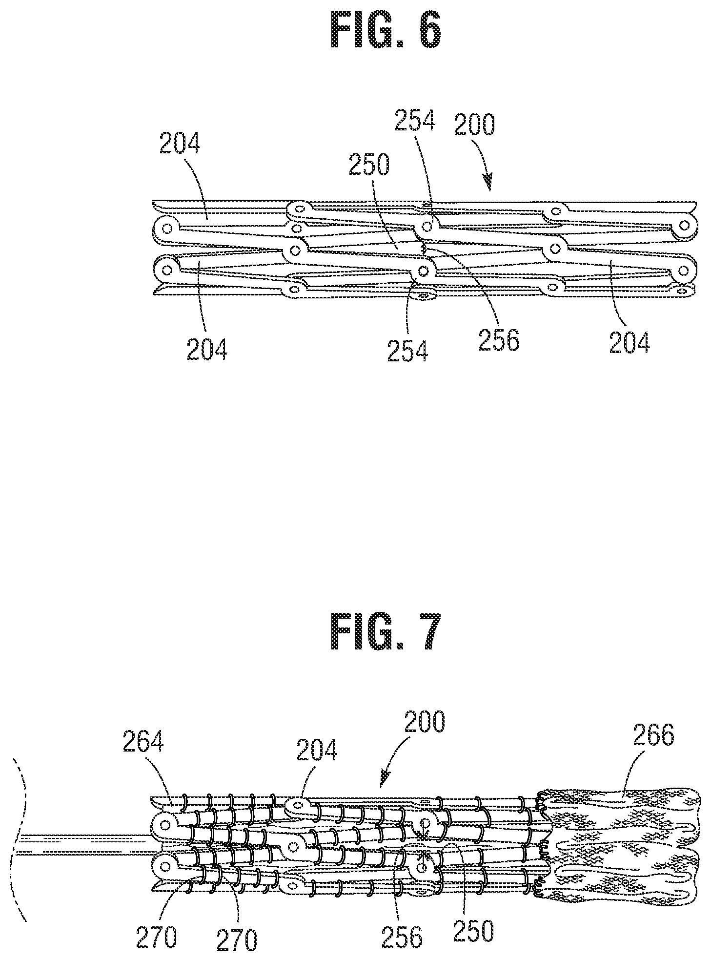 Patent US12318285 Figure 4 – Mechanically expandable heart valve