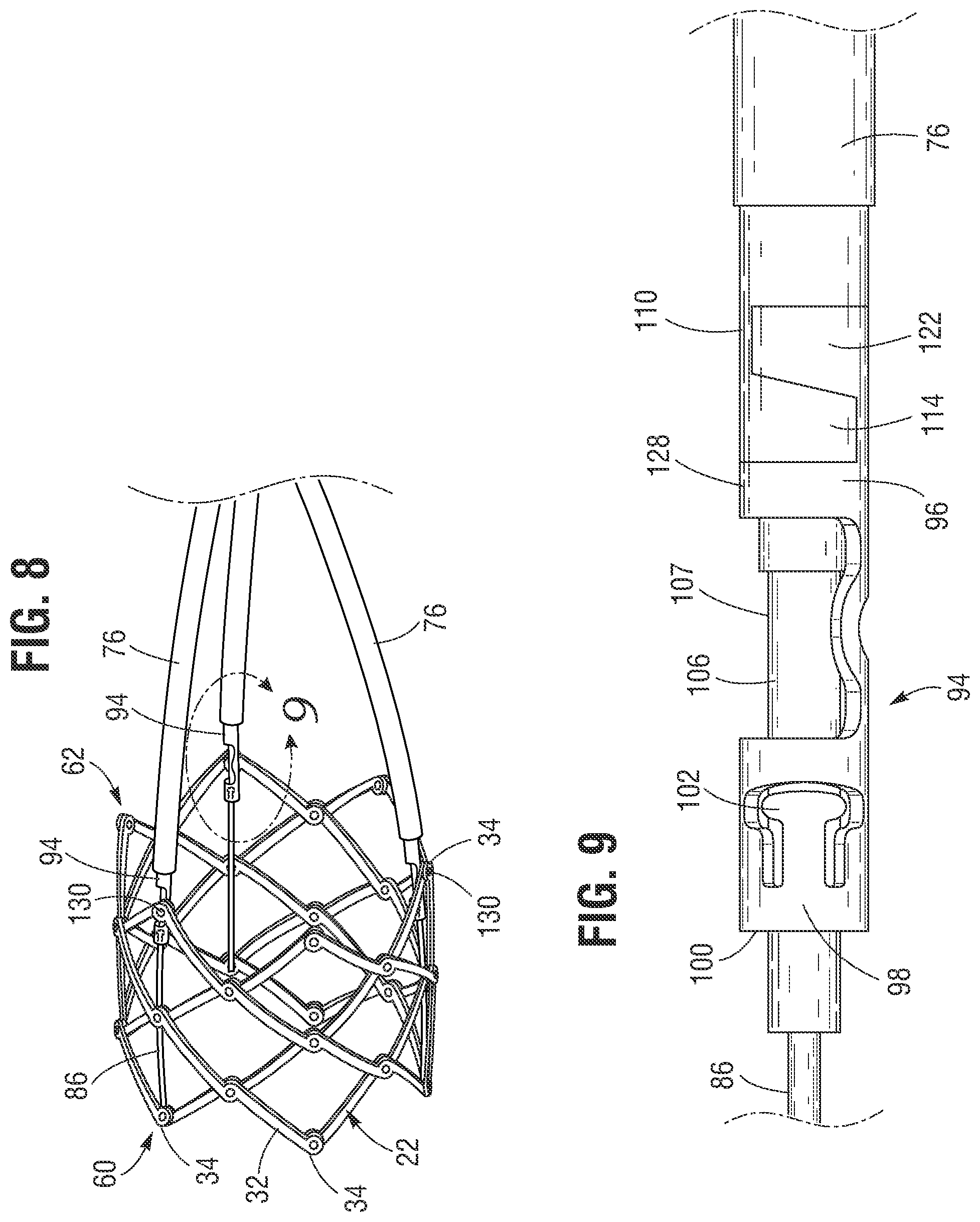 Patent US12318285 Figure 5 – Mechanically expandable heart valve