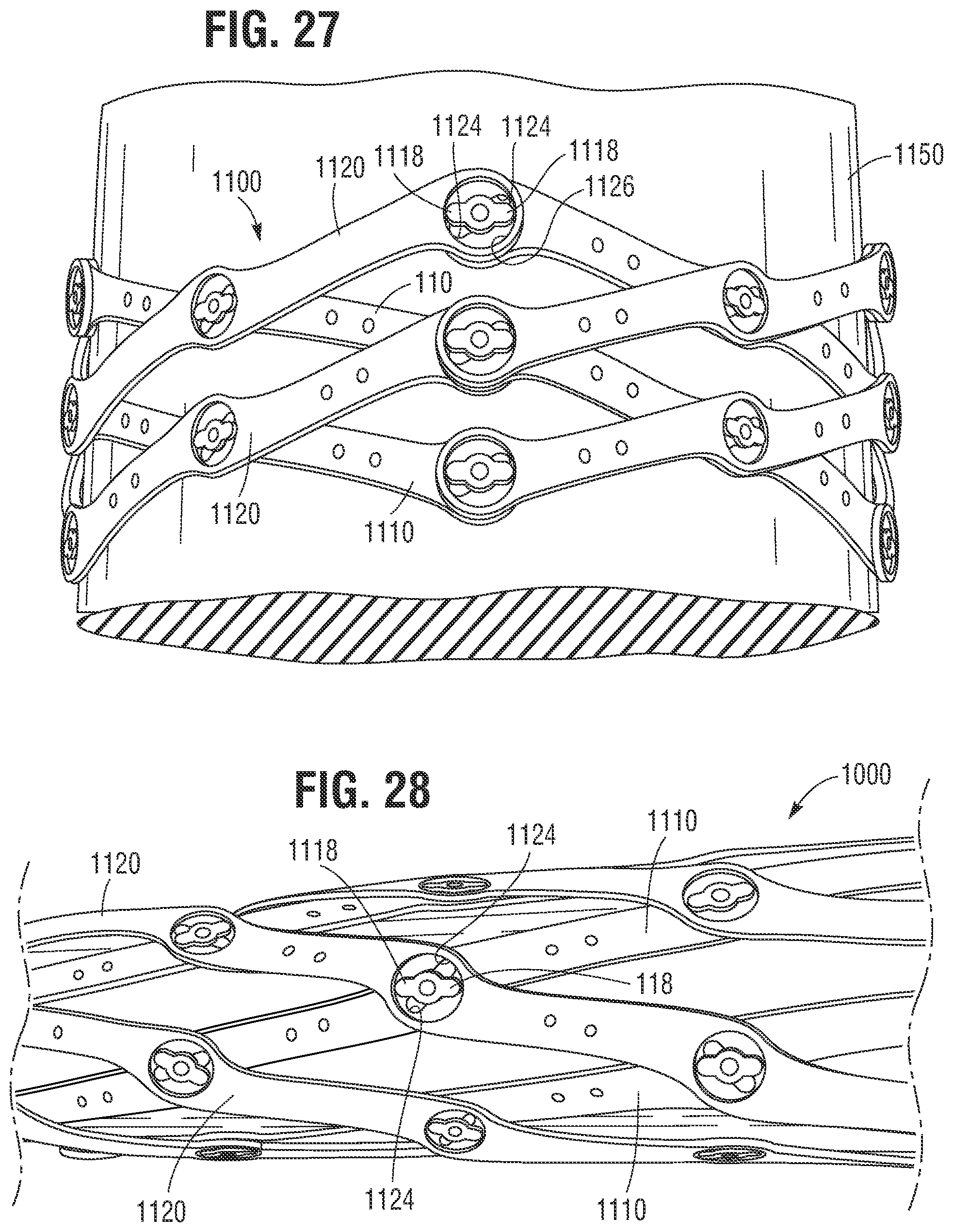 Patent US12318285 Figure 14 – Mechanically expandable heart valve