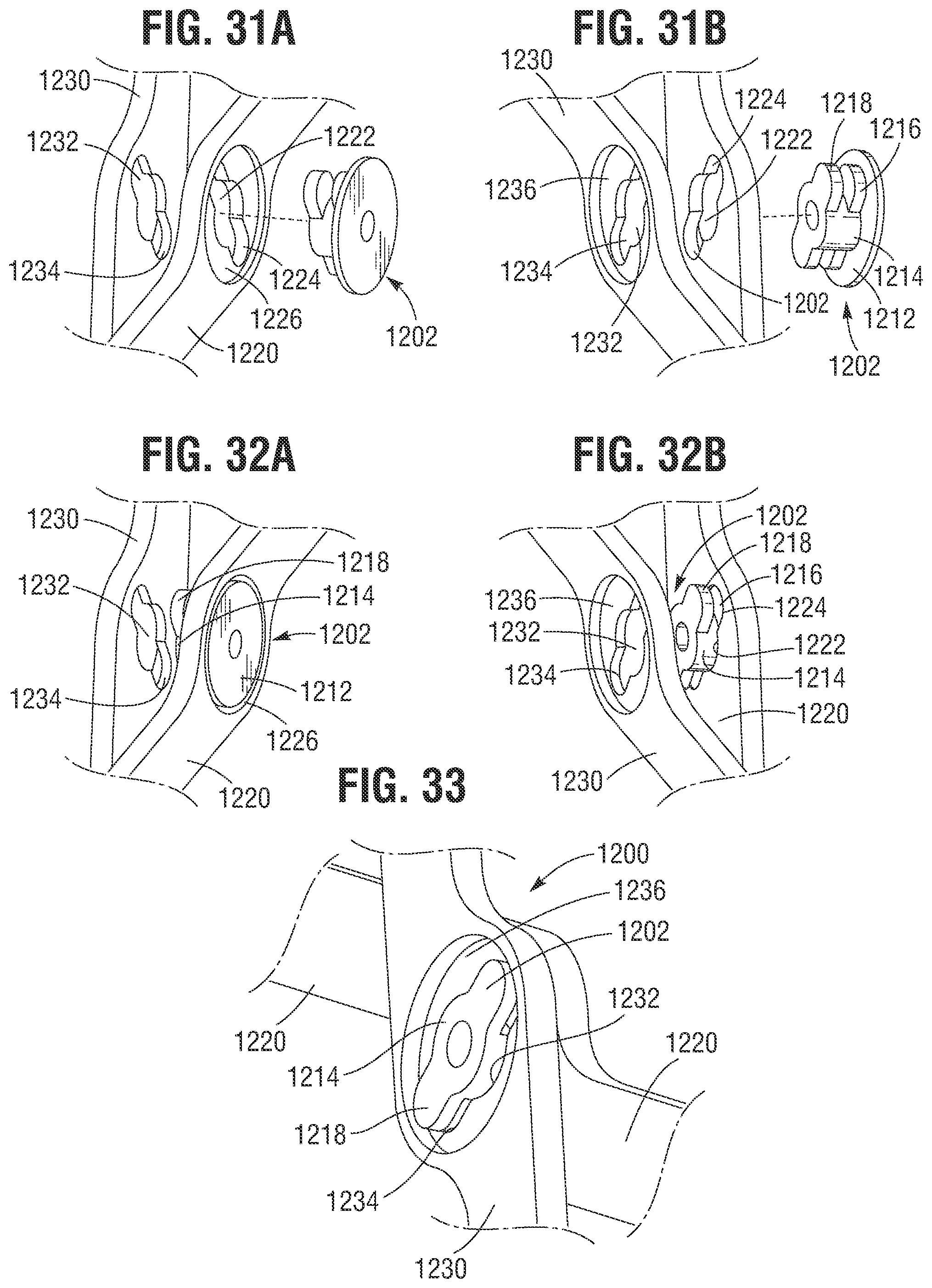 Patent US12318285 Figure 16 – Mechanically expandable heart valve