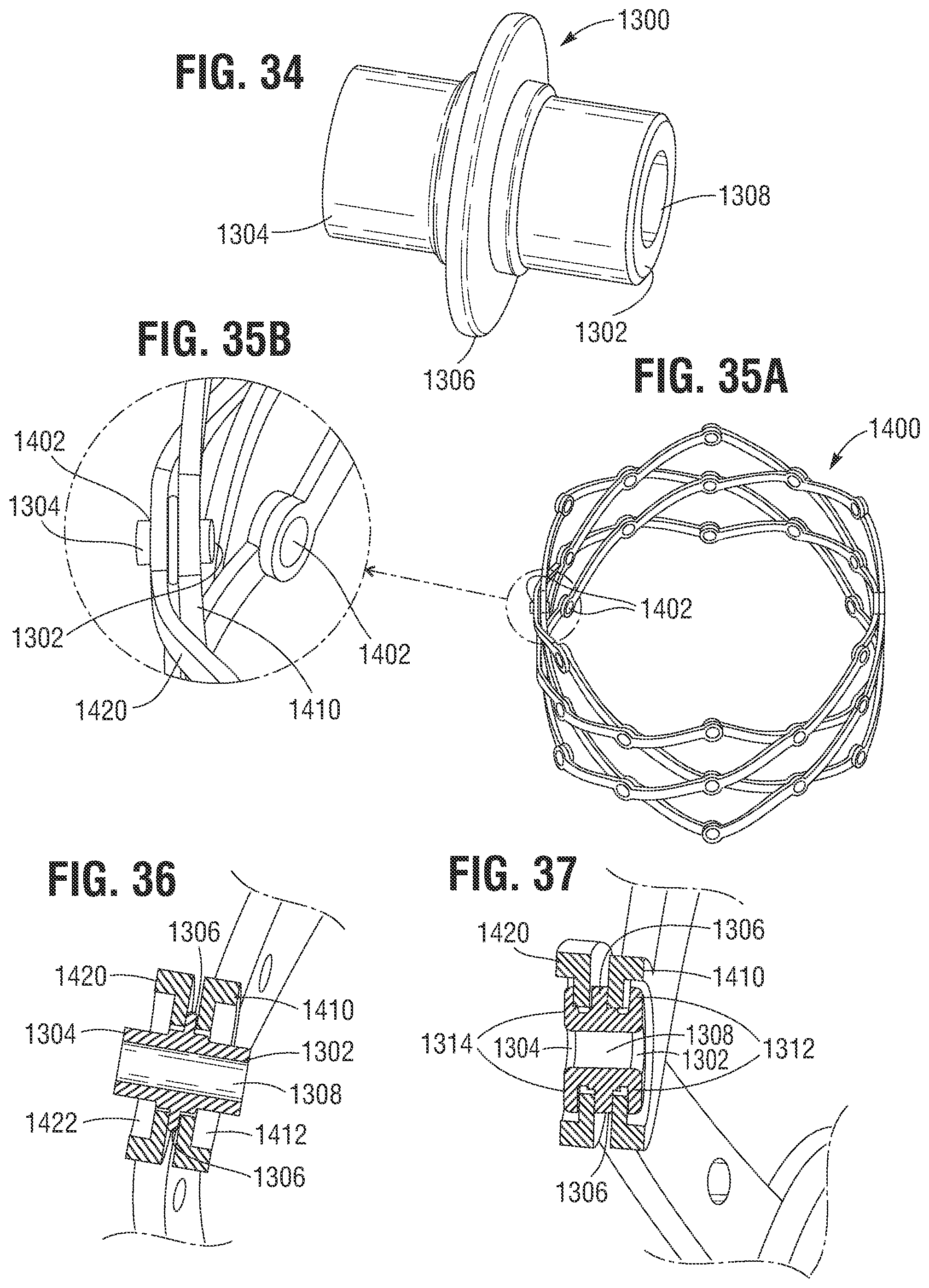 Patent US12318285 Figure 17 – Mechanically expandable heart valve