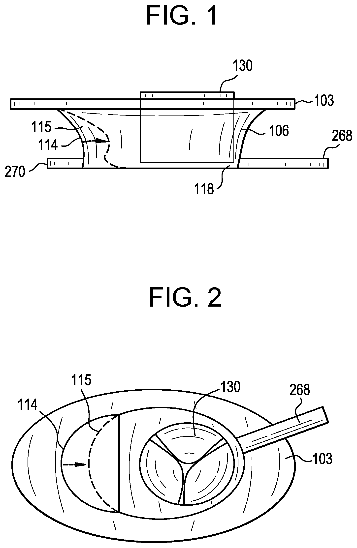 Patent US12318286 Figure 1 – Cinch device and method for deployment of a side-delivered prosthetic heart valve in a native annulus