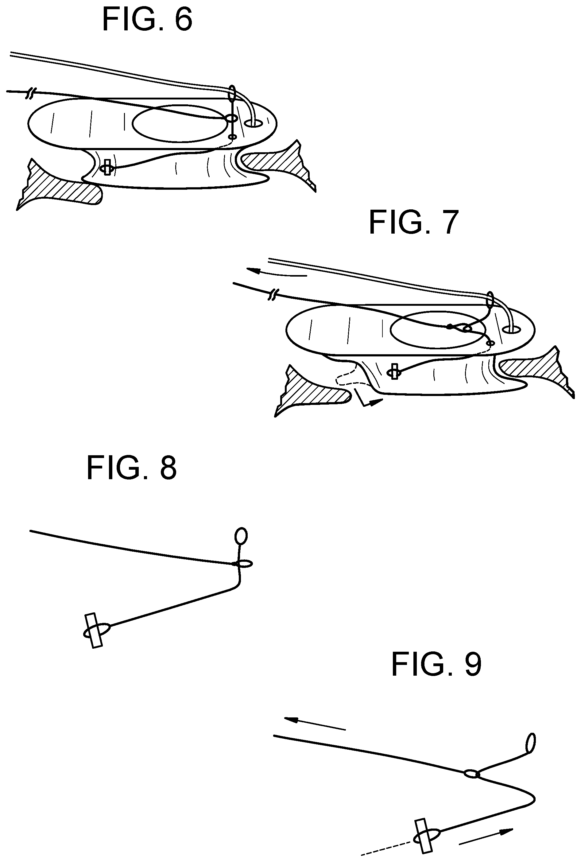 Patent US12318286 Figure 4 – Cinch device and method for deployment of a side-delivered prosthetic heart valve in a native annulus