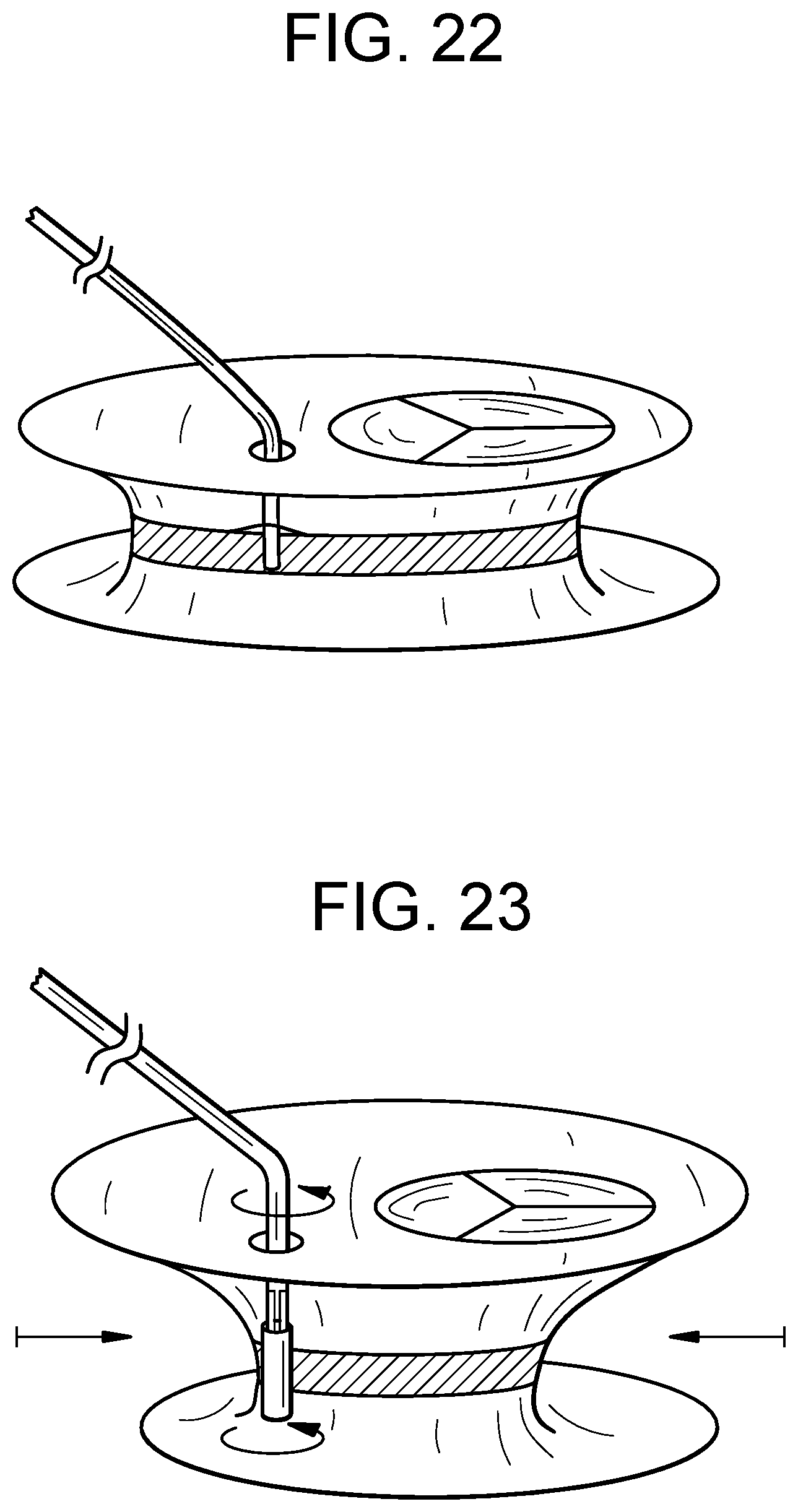 Patent US12318286 Figure 9 – Cinch device and method for deployment of a side-delivered prosthetic heart valve in a native annulus