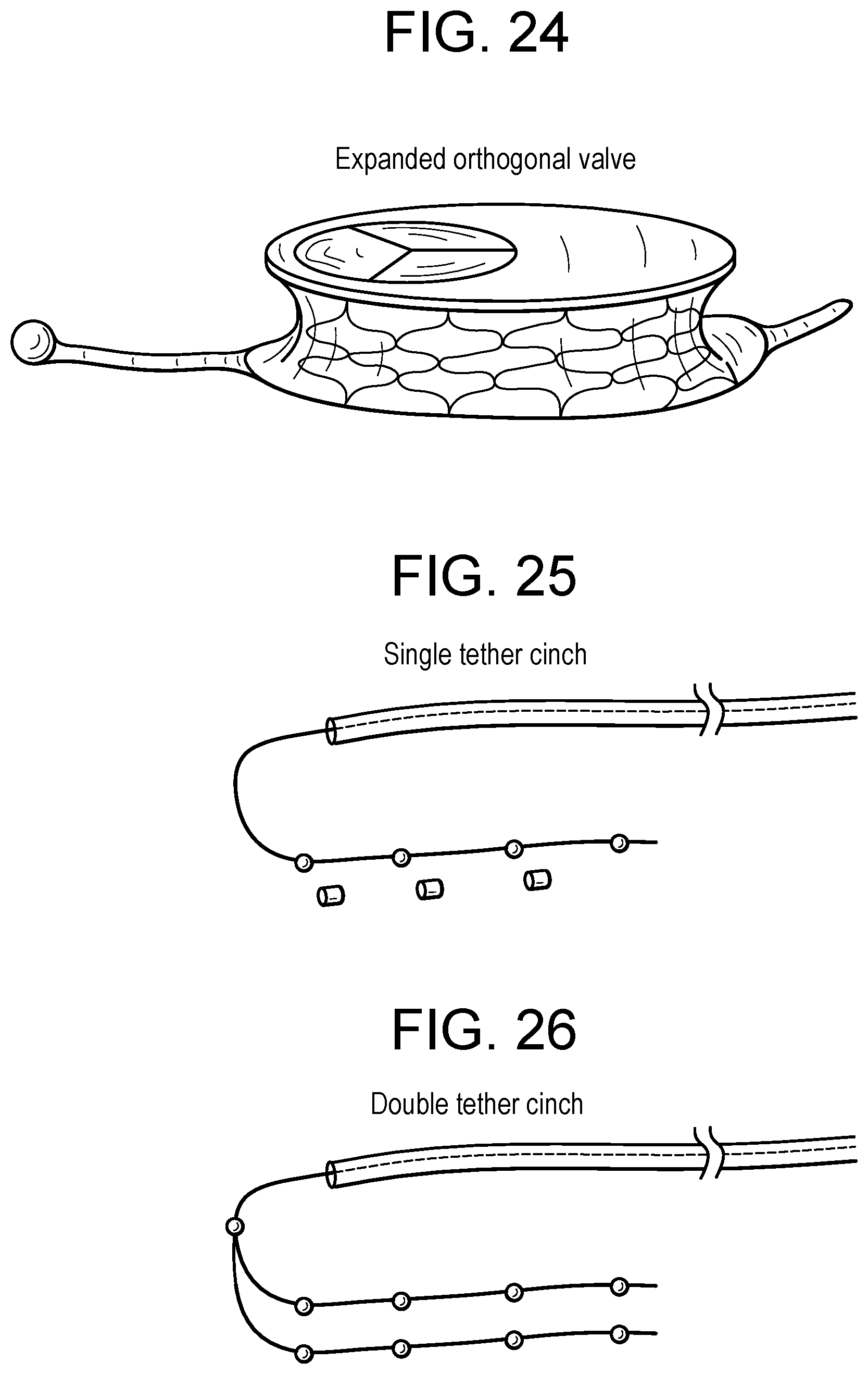 Patent US12318286 Figure 10 – Cinch device and method for deployment of a side-delivered prosthetic heart valve in a native annulus