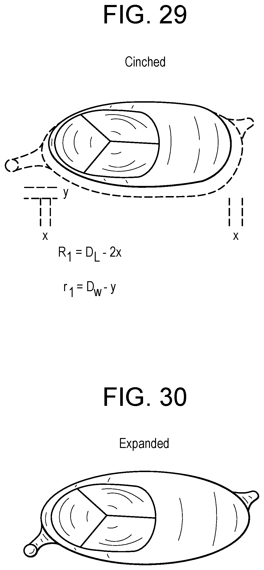 Patent US12318286 Figure 12 – Cinch device and method for deployment of a side-delivered prosthetic heart valve in a native annulus