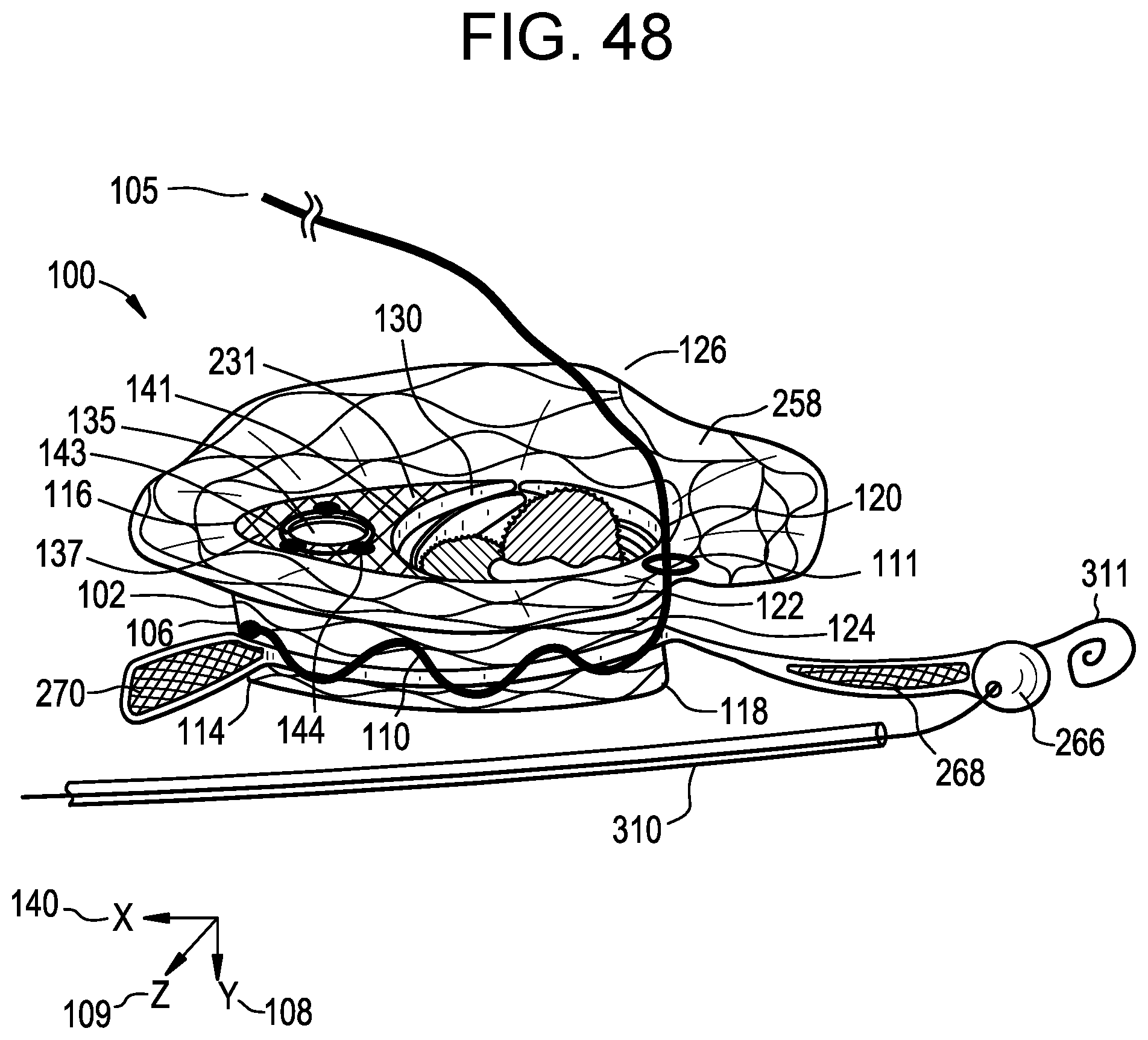 Patent US12318286 Figure 19 – Cinch device and method for deployment of a side-delivered prosthetic heart valve in a native annulus