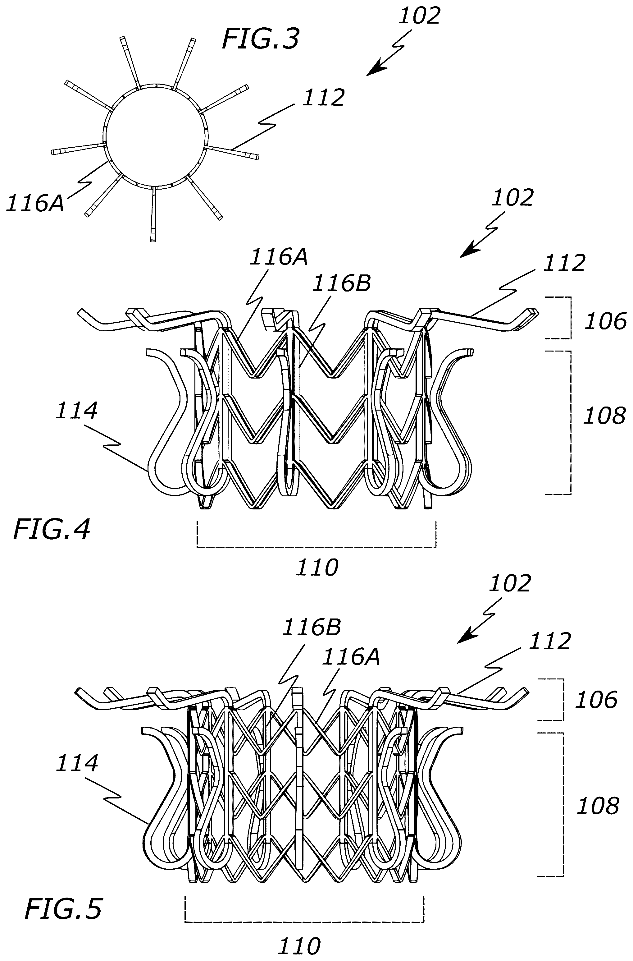 Patent US12318287 Figure 2 – Prosthetic heart valve, systems, and methods