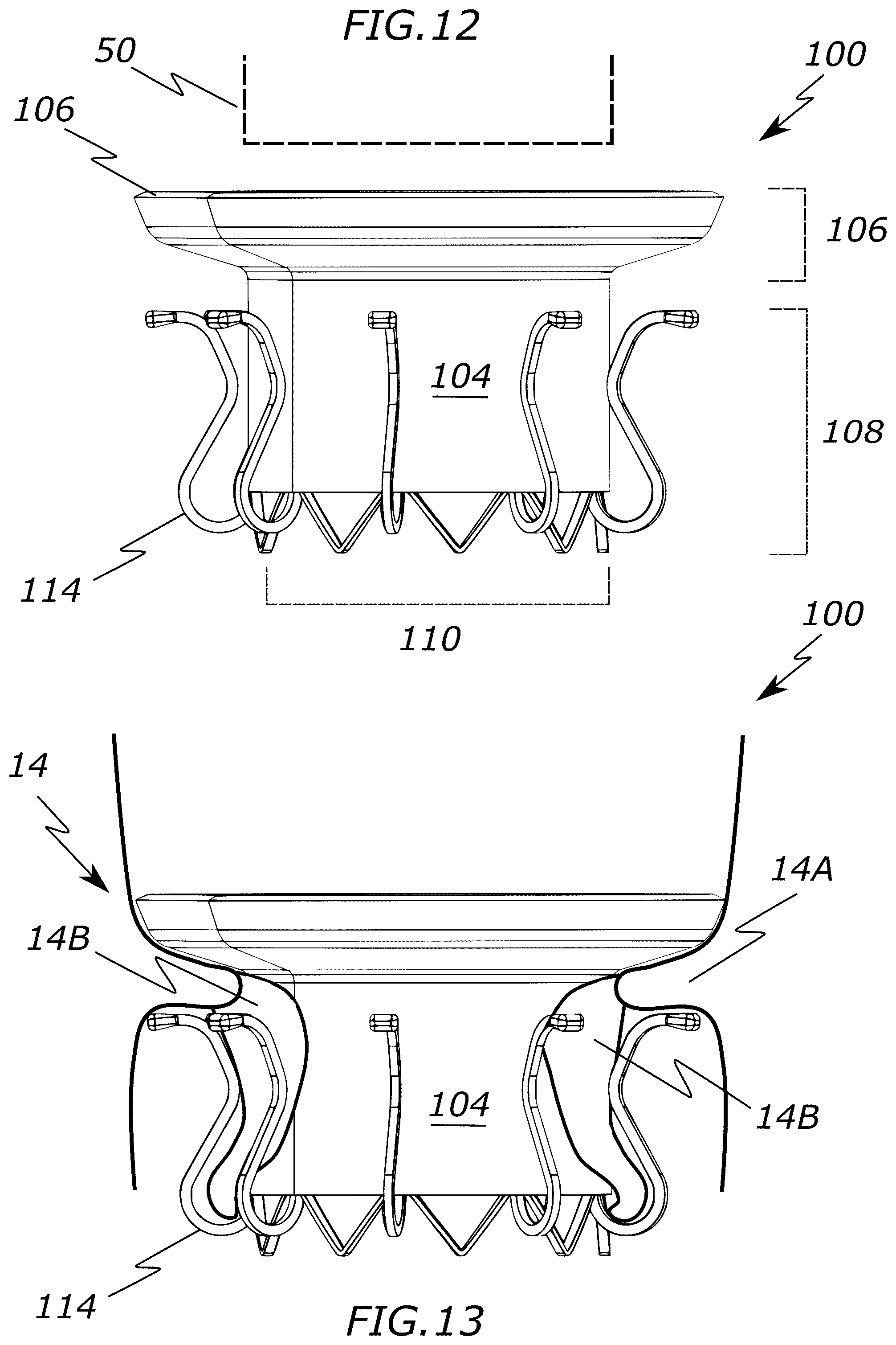 Patent US12318287 Figure 6 – Prosthetic heart valve, systems, and methods