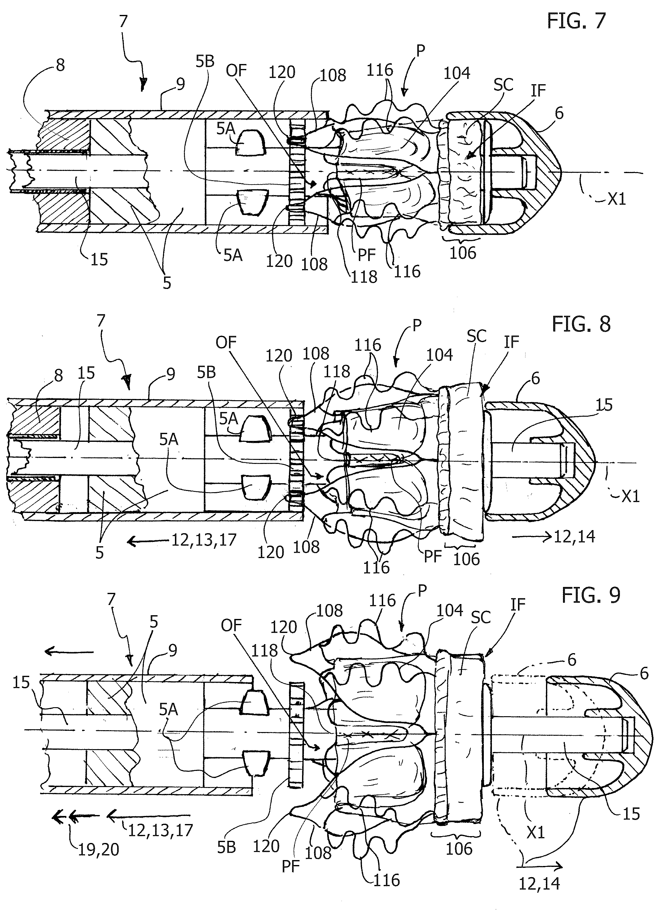 Patent US12318289 Figure 9 – Device for the in-situ delivery of heart valve prosthesis