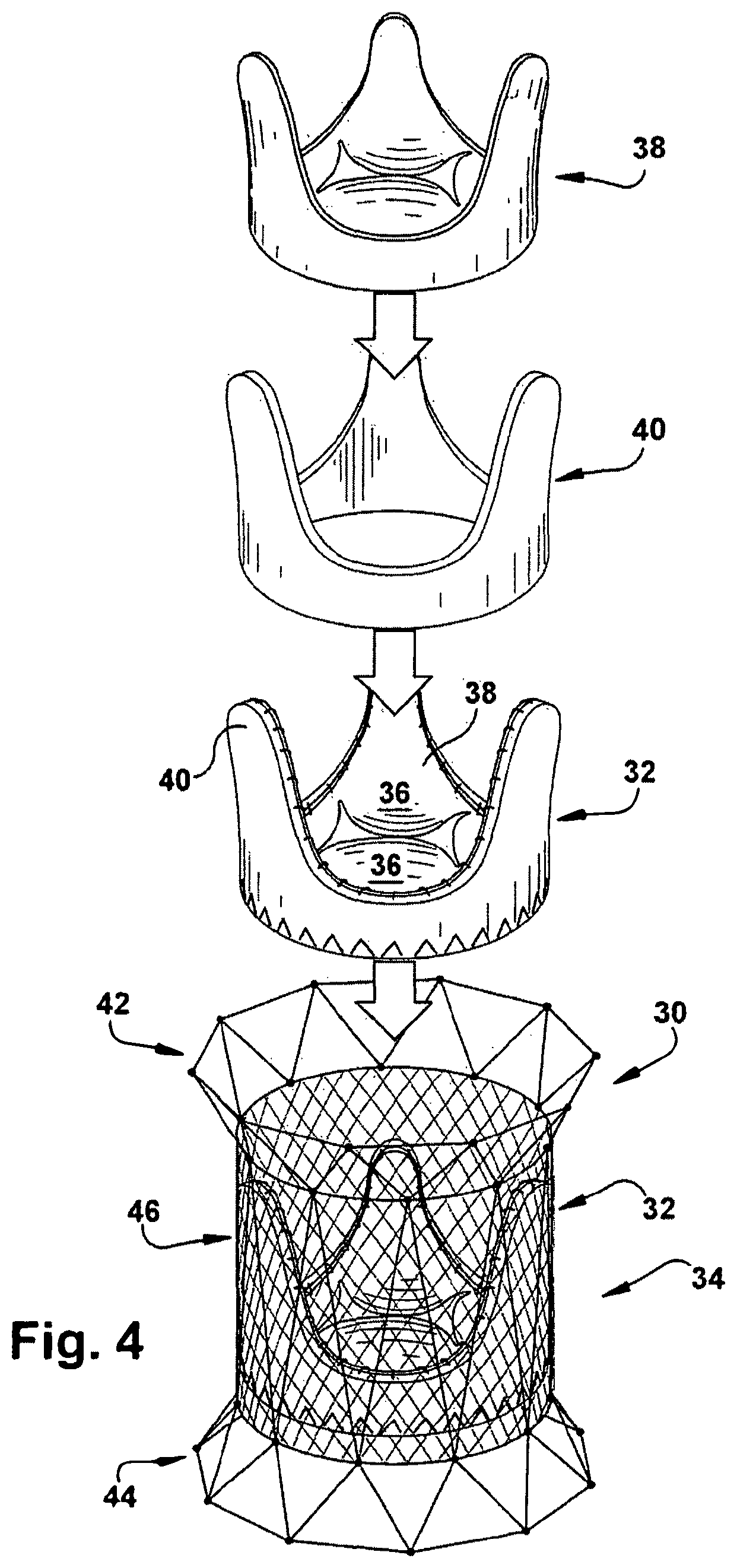 Patent US12318291 Figure 4 – Method for implanting a cardiovascular valve