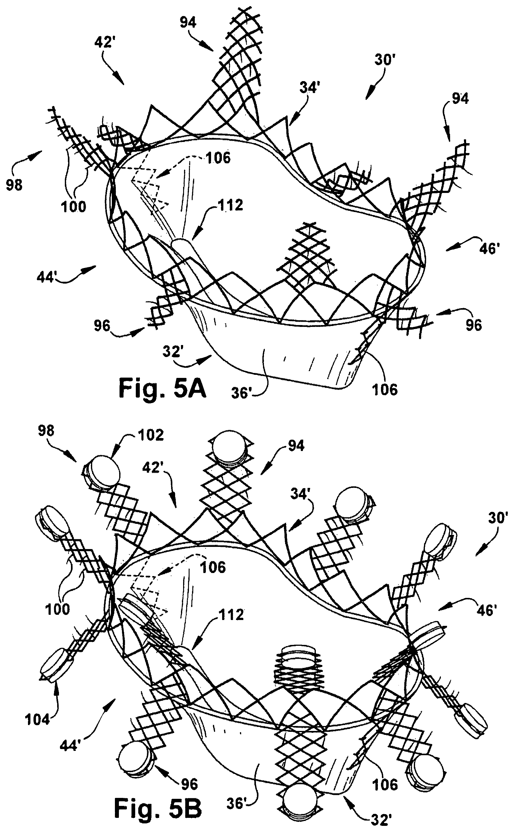 Patent US12318291 Figure 5 – Method for implanting a cardiovascular valve
