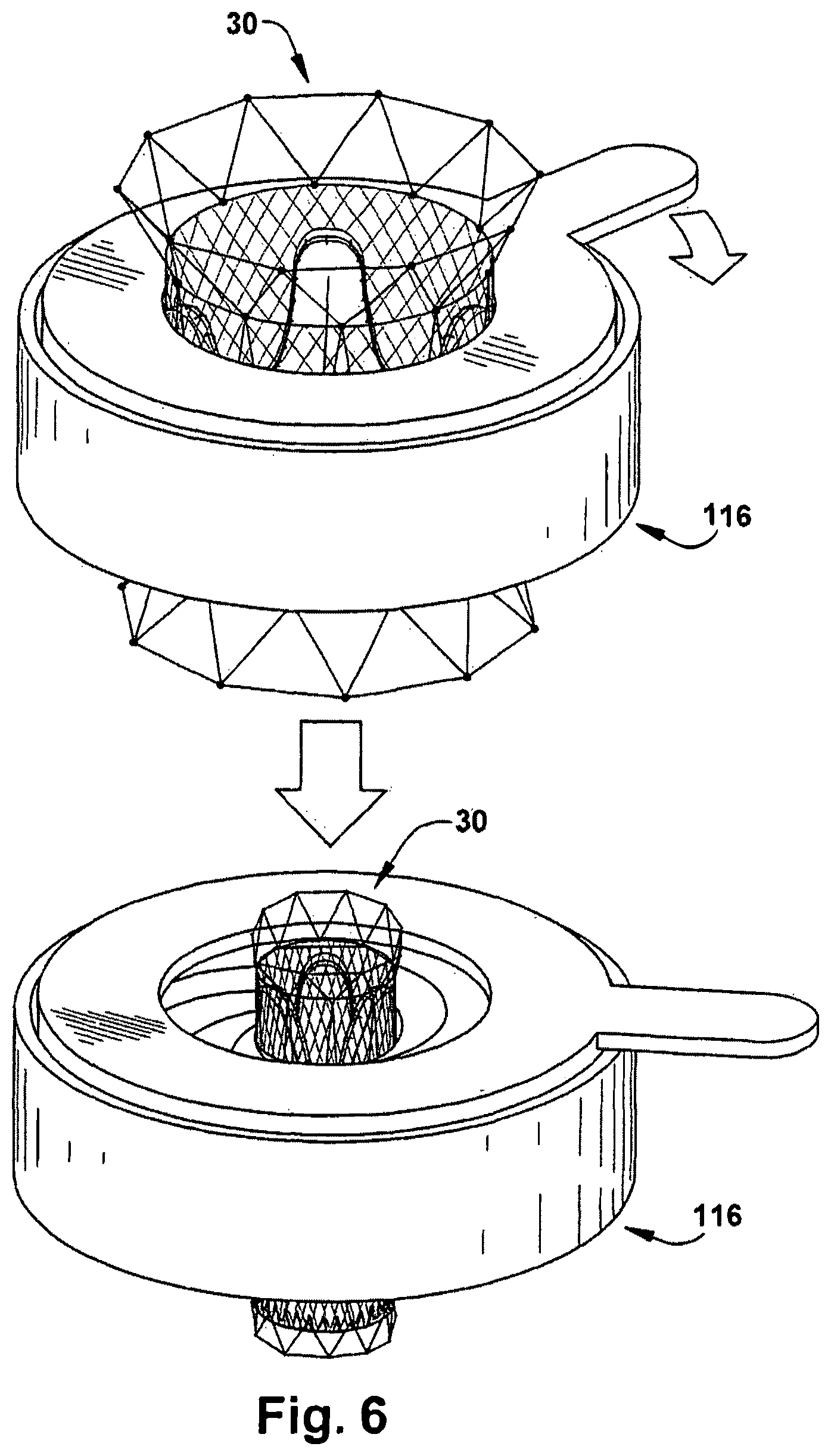 Patent US12318291 Figure 6 – Method for implanting a cardiovascular valve