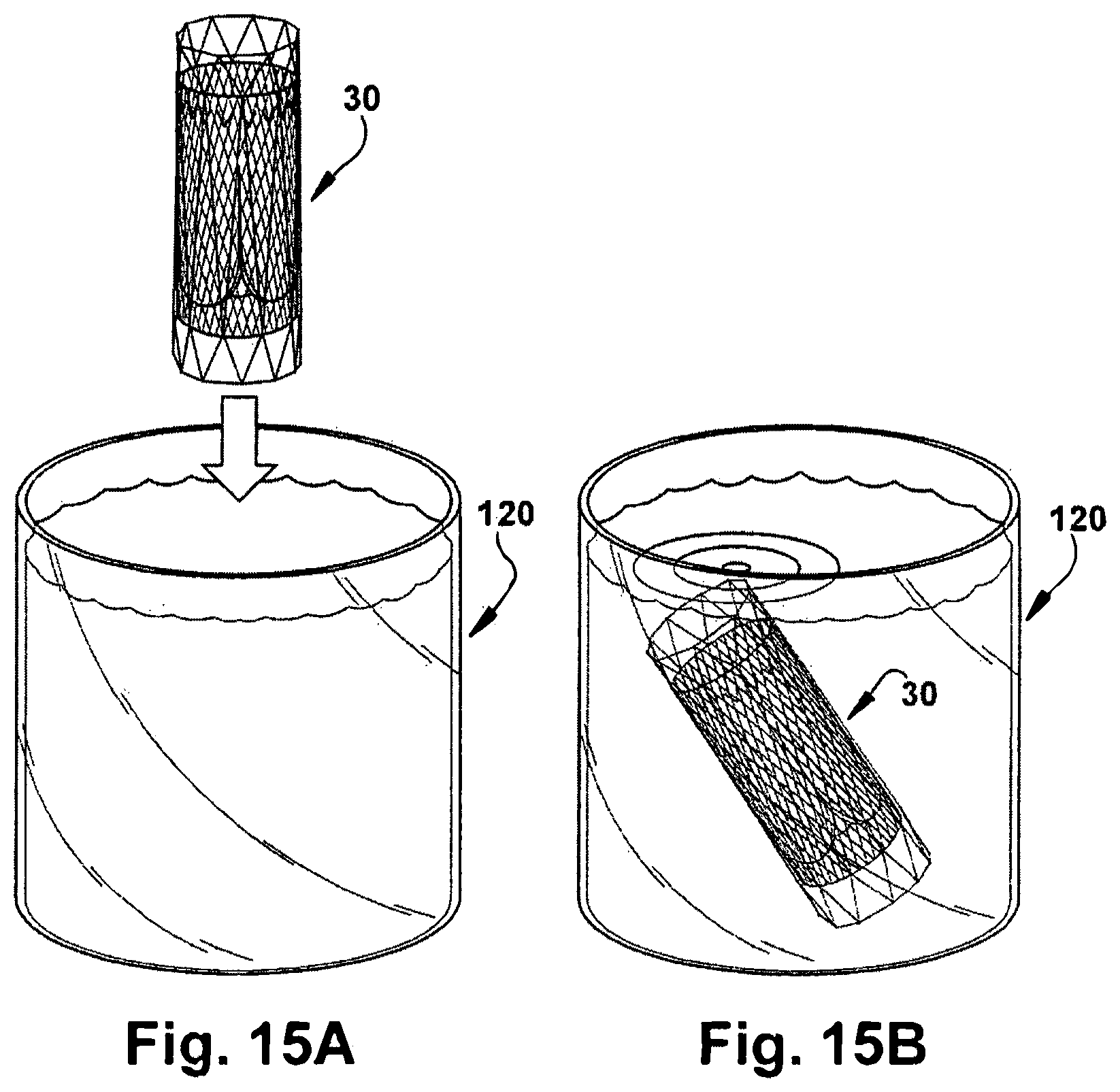 Patent US12318291 Figure 15 – Method for implanting a cardiovascular valve