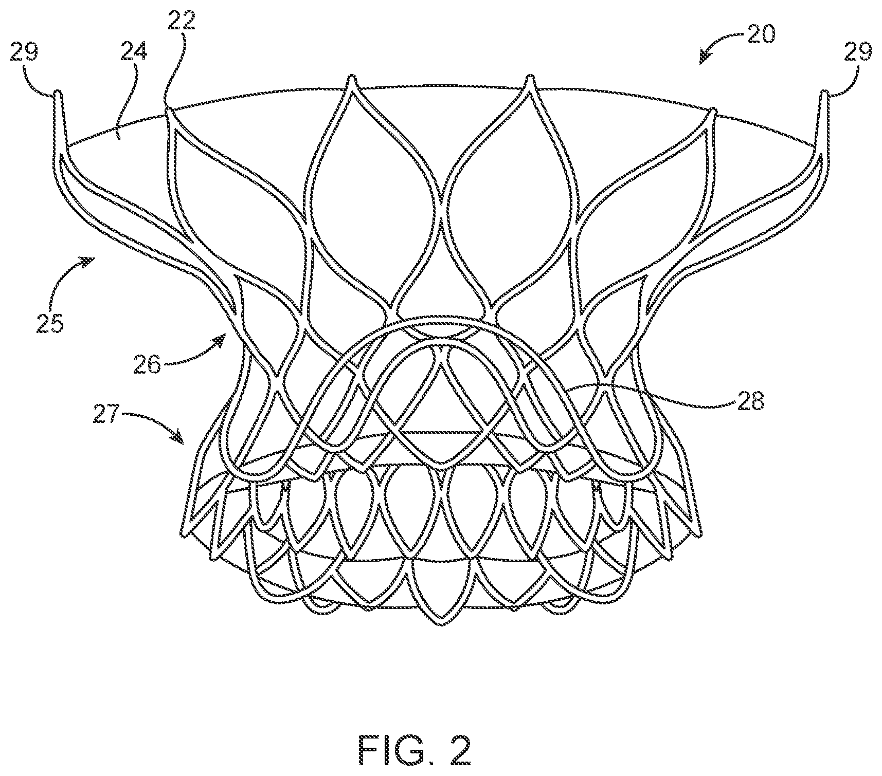 Patent US12318293 Figure 2 – System and method of stepped deployment of prosthetic heart valve