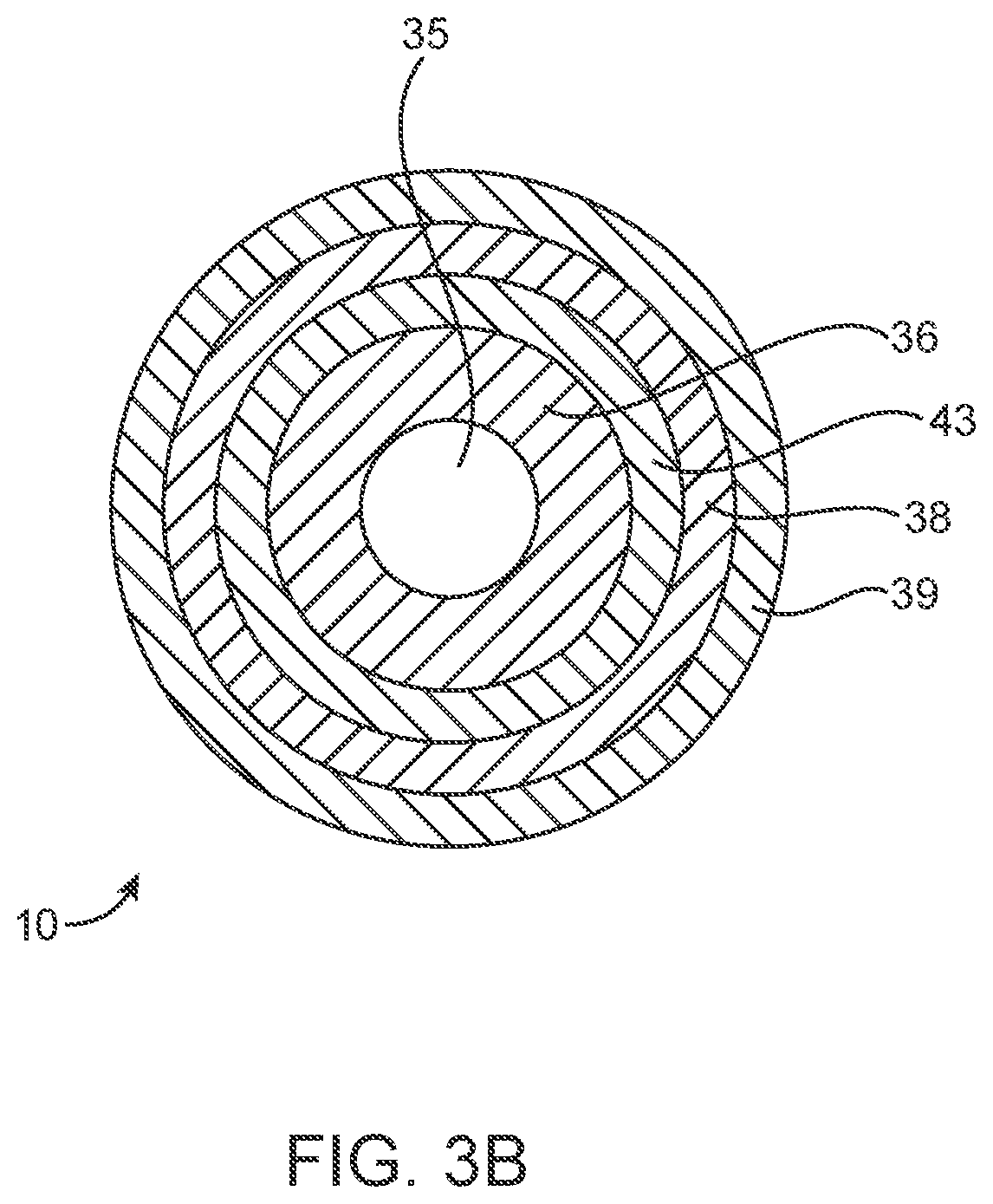Patent US12318293 Figure 4 – System and method of stepped deployment of prosthetic heart valve