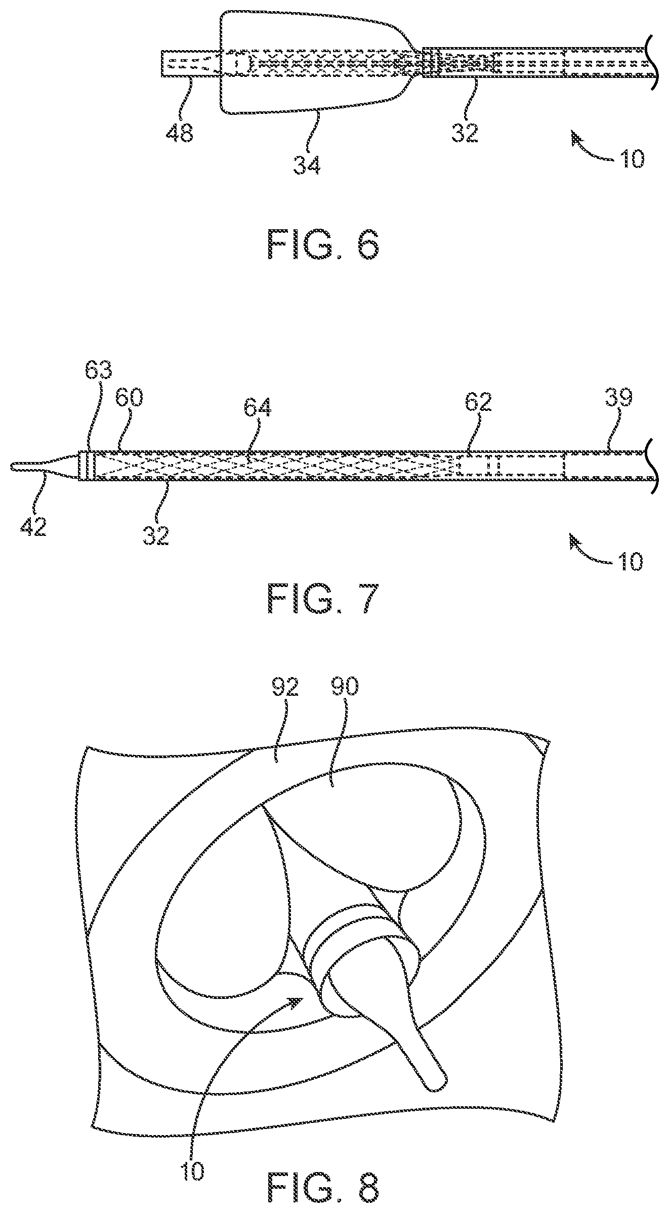 Patent US12318293 Figure 5 – System and method of stepped deployment of prosthetic heart valve