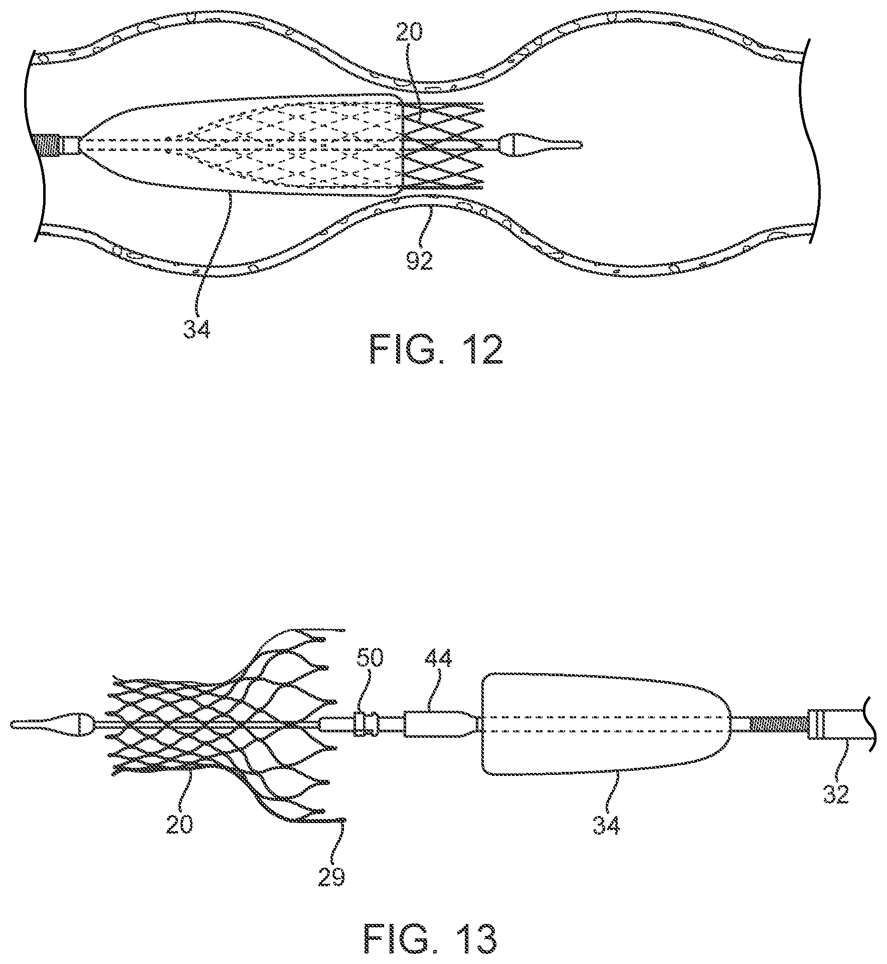 Patent US12318293 Figure 7 – System and method of stepped deployment of prosthetic heart valve