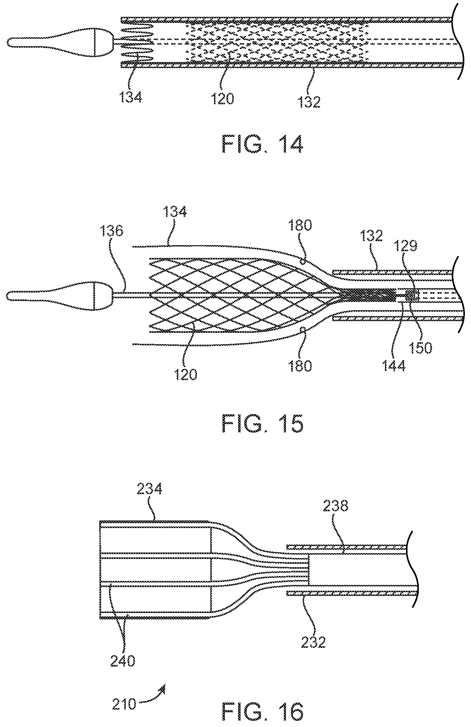 Patent US12318293 Figure 8 – System and method of stepped deployment of prosthetic heart valve
