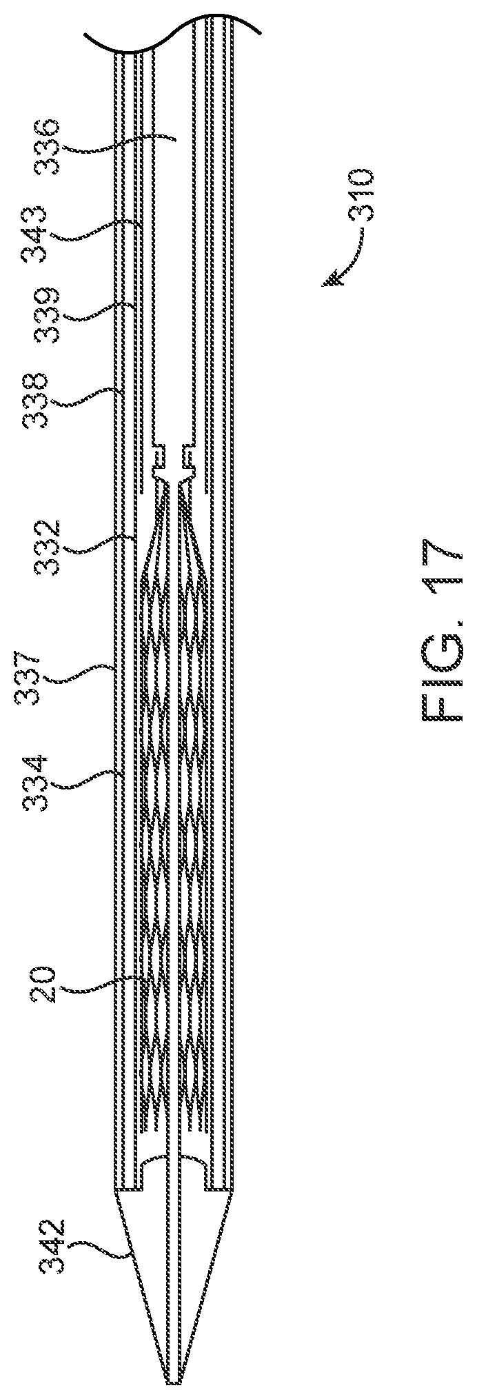 Patent US12318293 Figure 9 – System and method of stepped deployment of prosthetic heart valve
