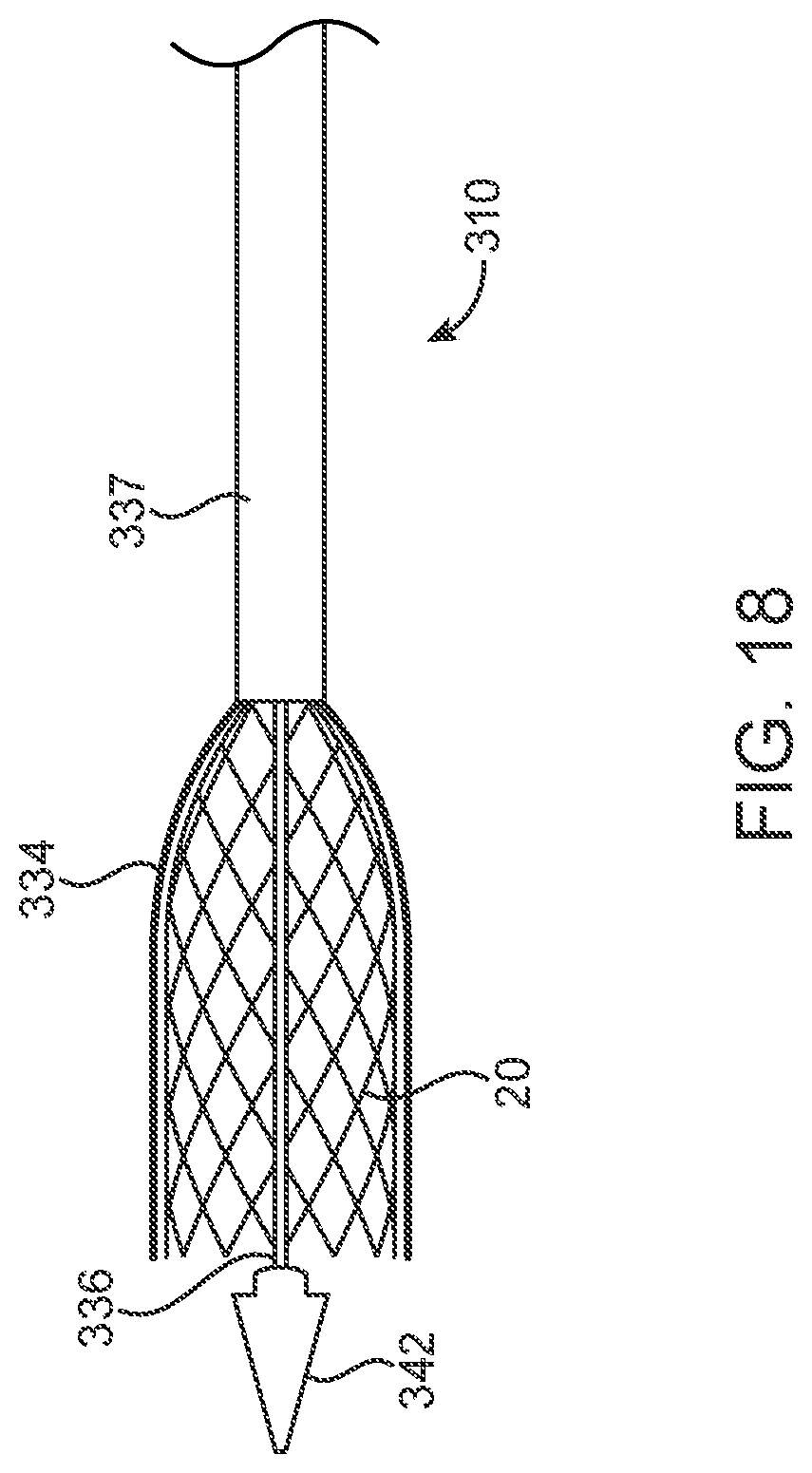 Patent US12318293 Figure 10 – System and method of stepped deployment of prosthetic heart valve