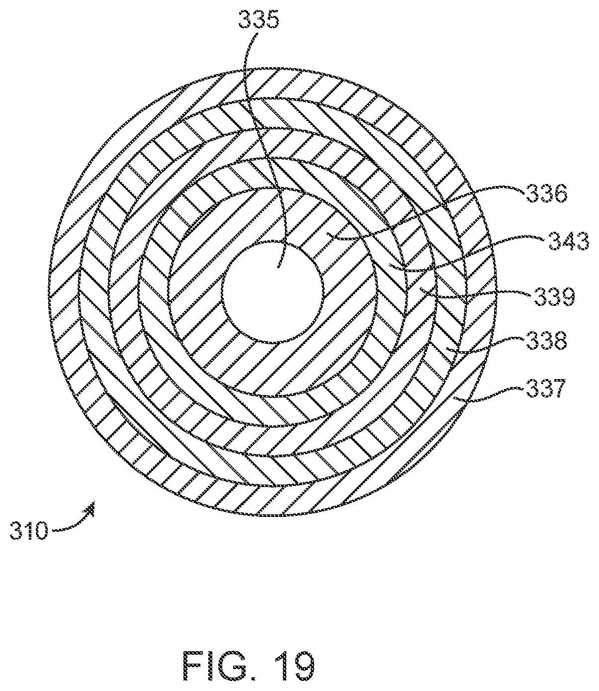 Patent US12318293 Figure 11 – System and method of stepped deployment of prosthetic heart valve
