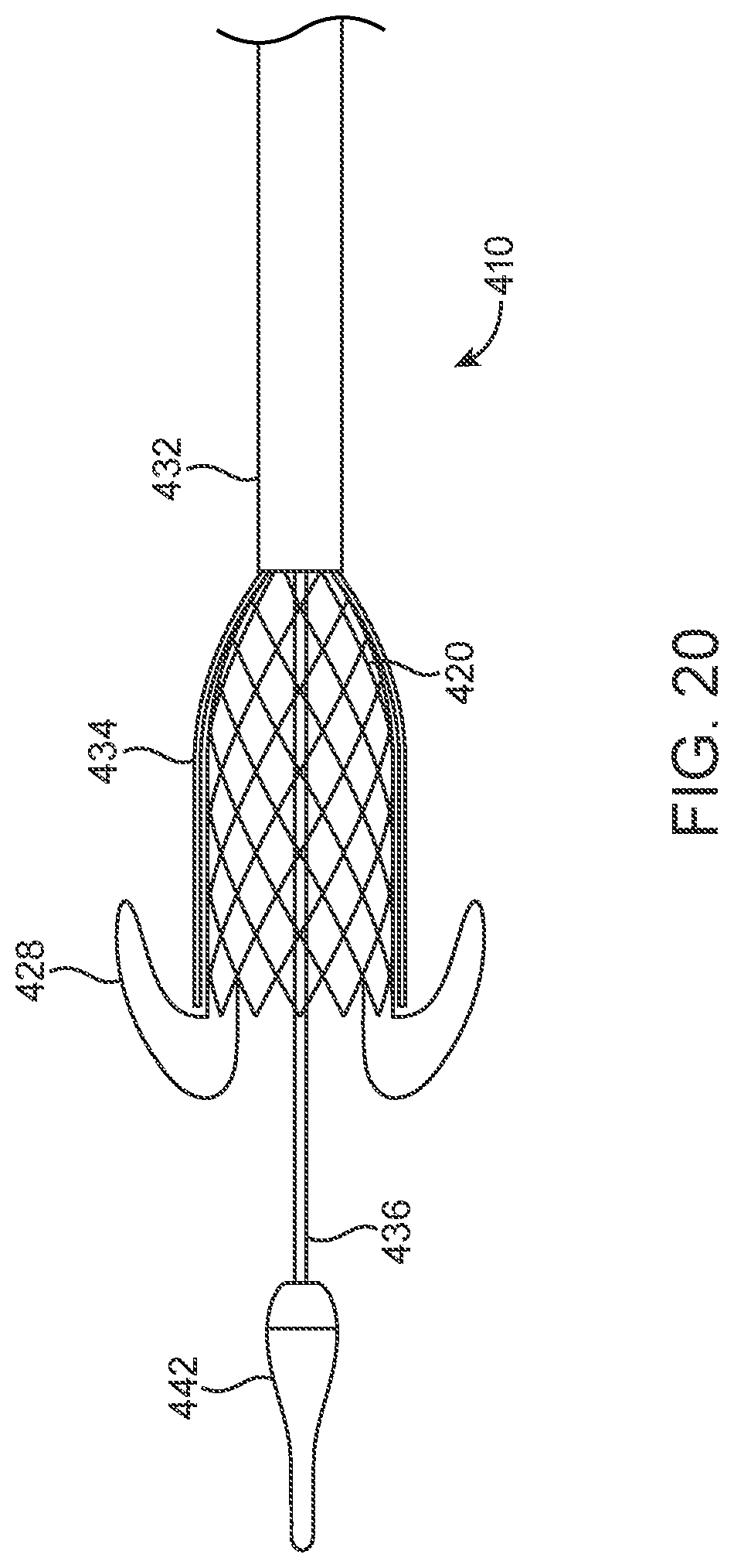 Patent US12318293 Figure 12 – System and method of stepped deployment of prosthetic heart valve