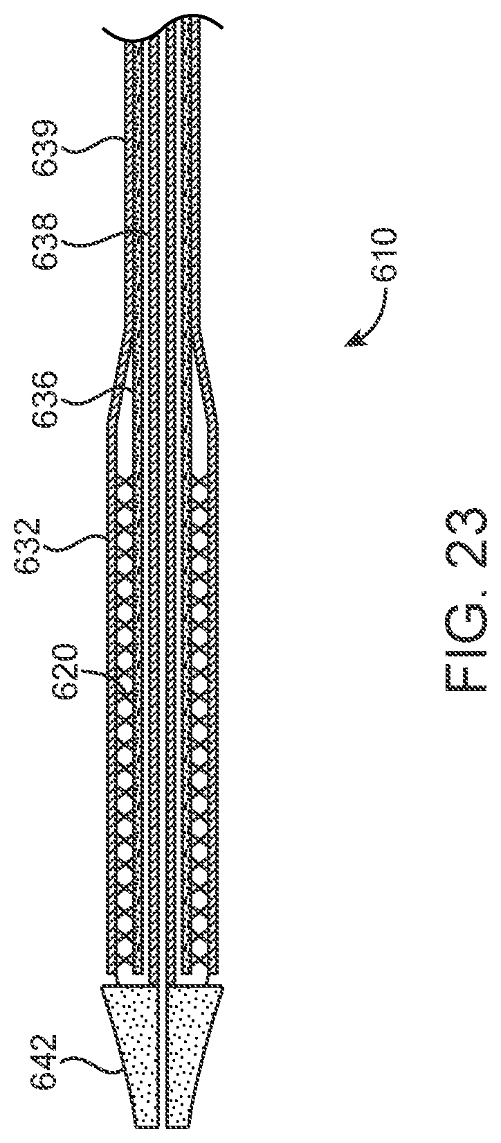 Patent US12318293 Figure 14 – System and method of stepped deployment of prosthetic heart valve