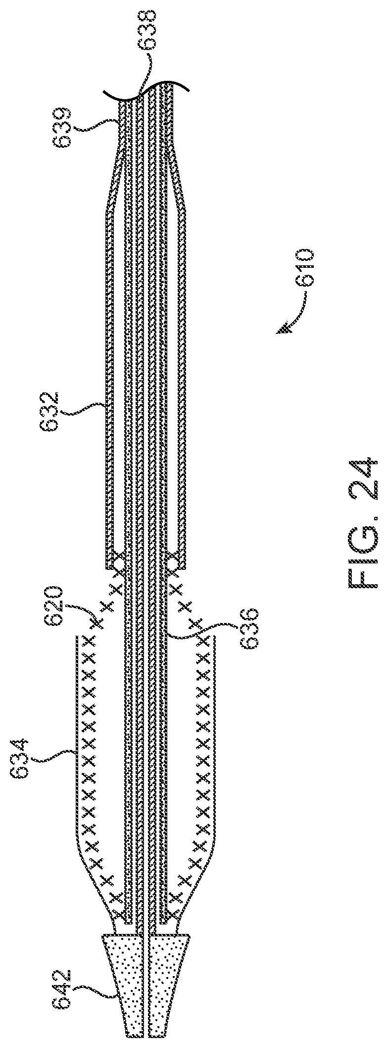 Patent US12318293 Figure 15 – System and method of stepped deployment of prosthetic heart valve