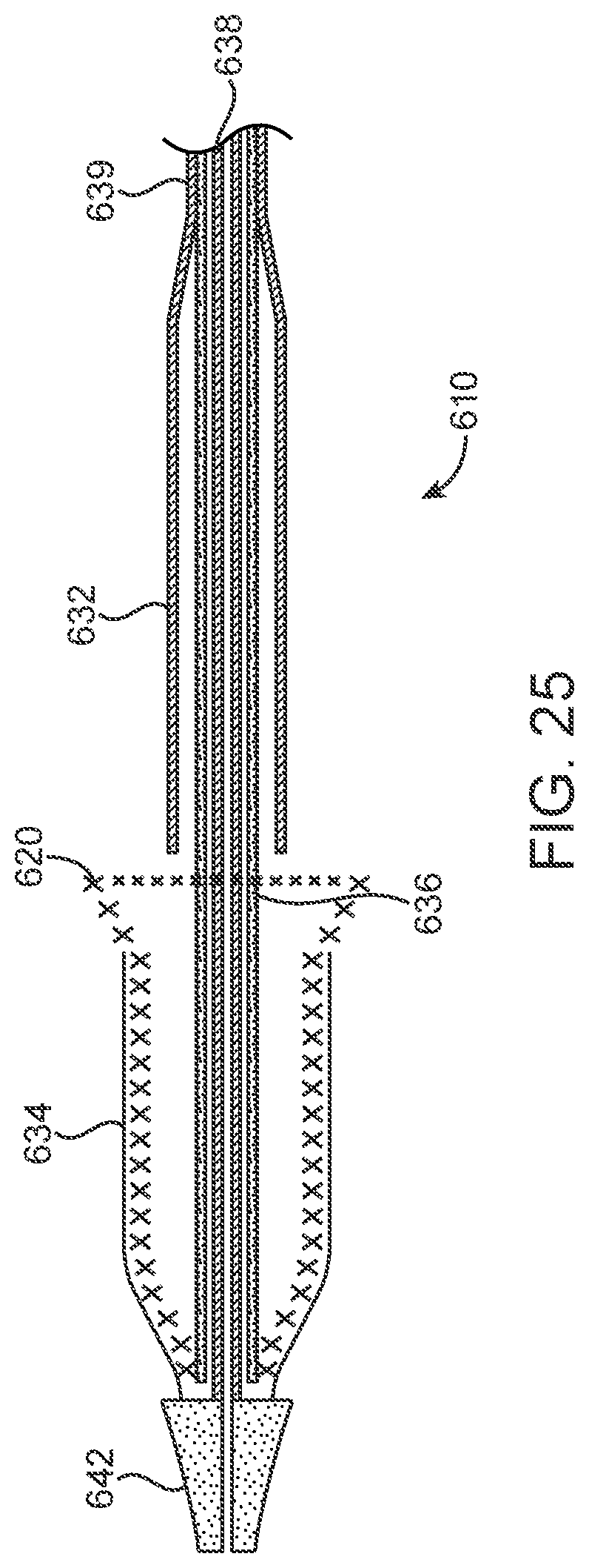 Patent US12318293 Figure 16 – System and method of stepped deployment of prosthetic heart valve