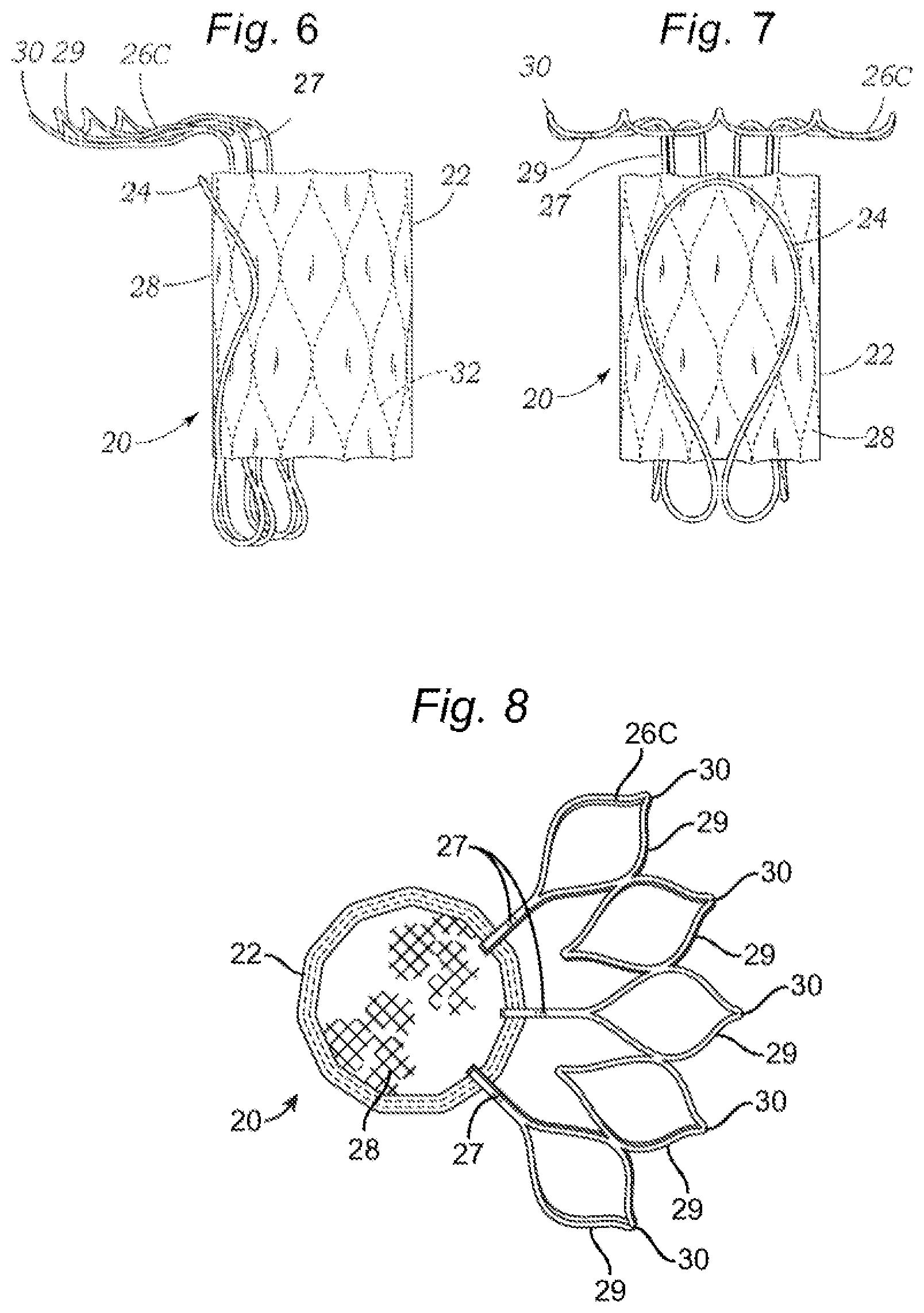 Patent US12318294 Figure 3 – Tissue grasping devices and related methods