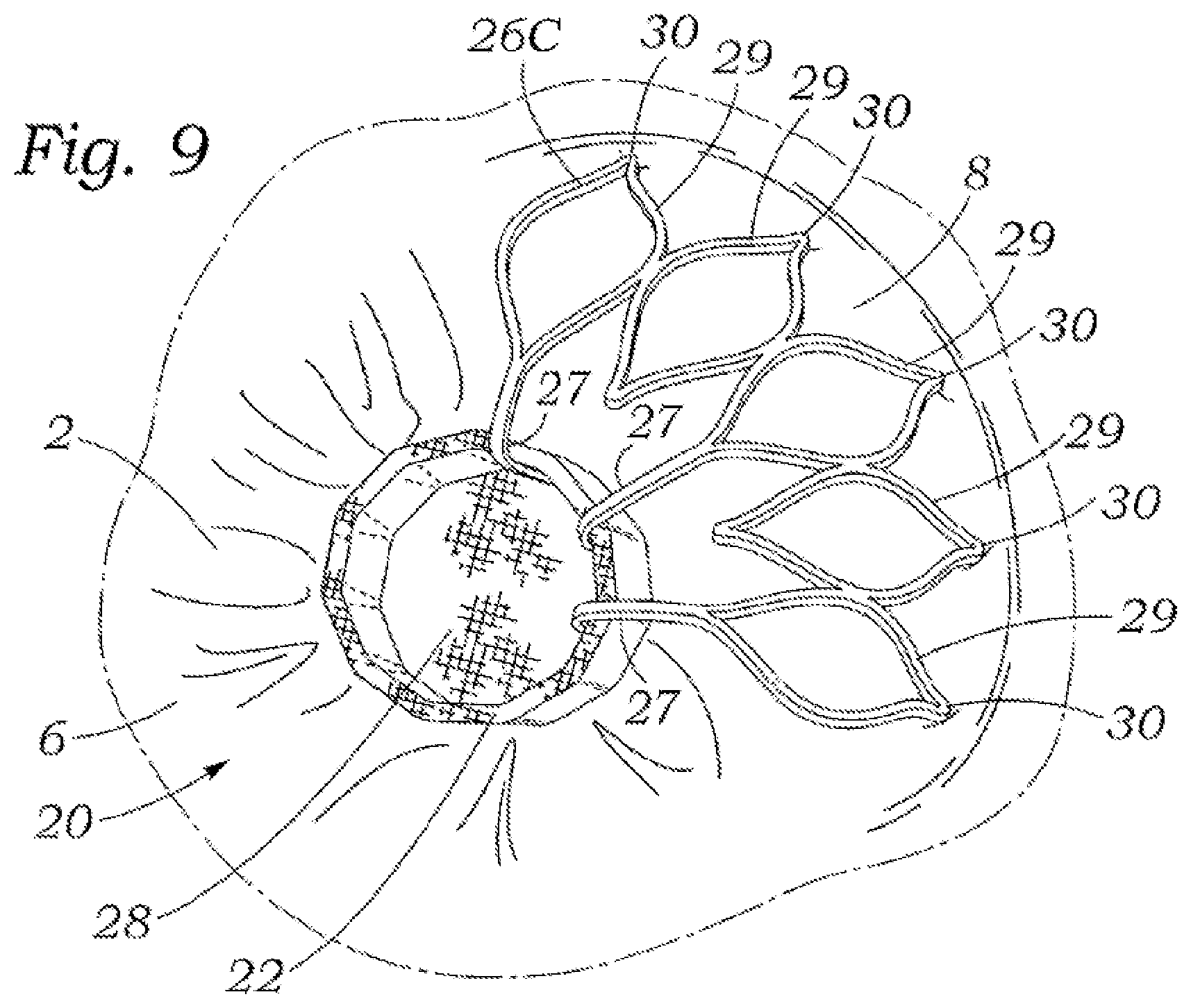 Patent US12318294 Figure 4 – Tissue grasping devices and related methods