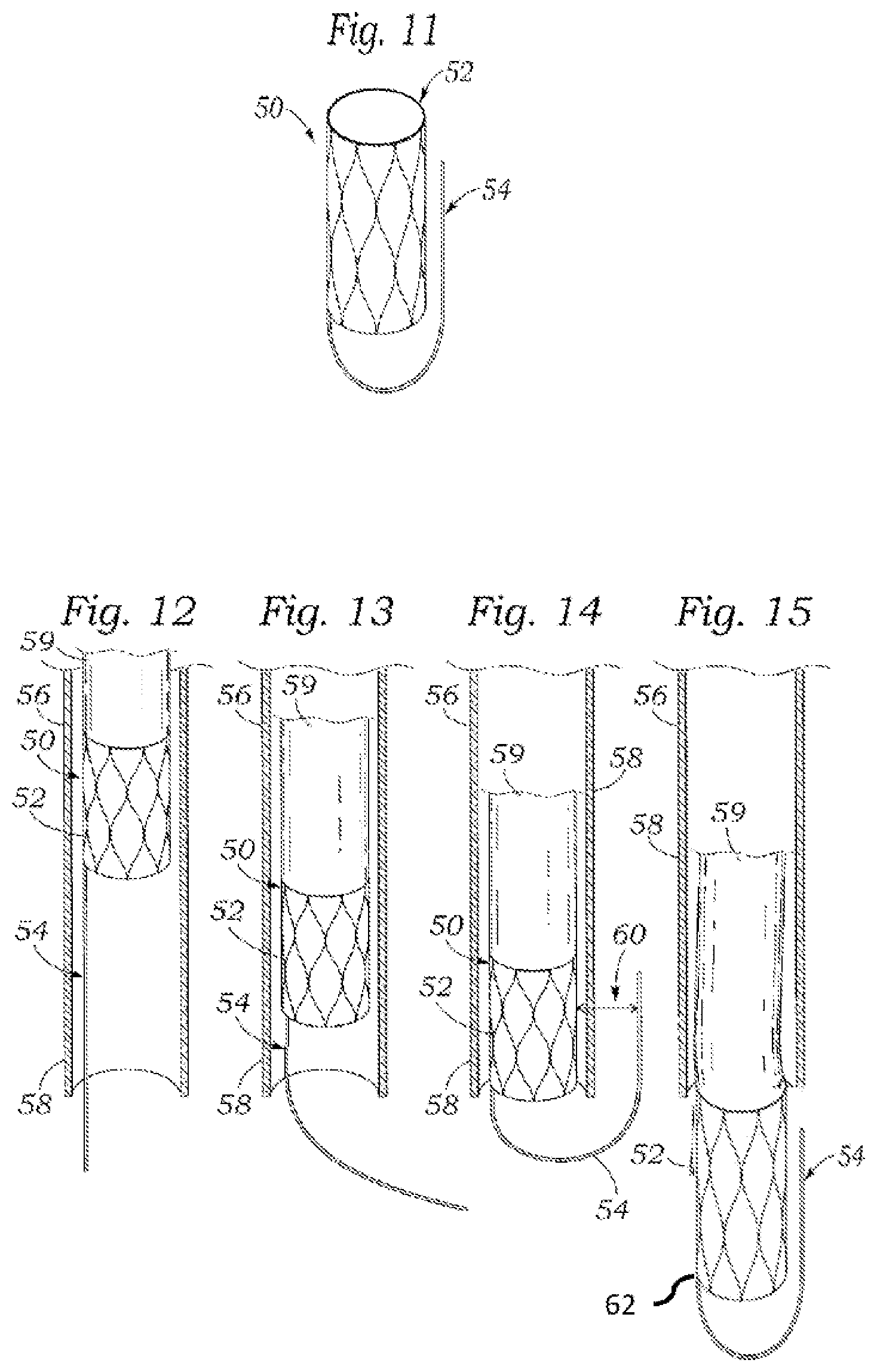 Patent US12318294 Figure 6 – Tissue grasping devices and related methods